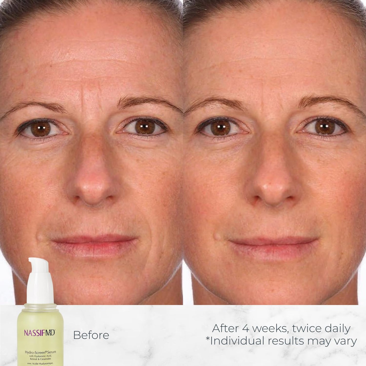 NassifMD Hydro-Screen Hydration Serum | Surgeon-Created Hyaluronic Acid, Ceramides & Retinol Formula for Plumping, Firming & Reducing Fine Lines Beauty & Personal Care NASSIFMD