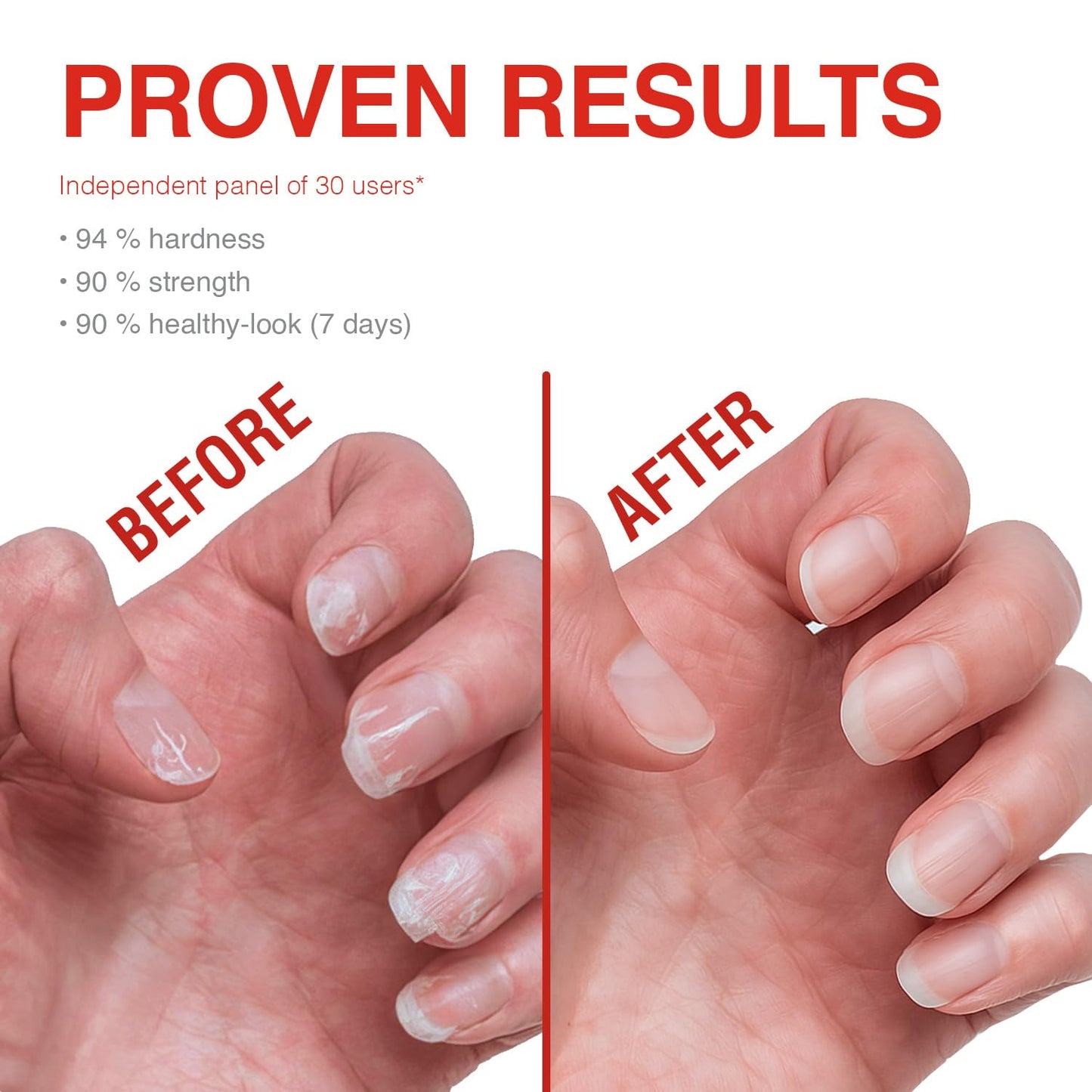 Probelle Nail Strengthener and growth, Natural Nail Strengthening Clear Nail Polish Repair Treatment, Nail Growth & Conditioning, Stops Splits, Chips Beauty & Personal Care Probelle