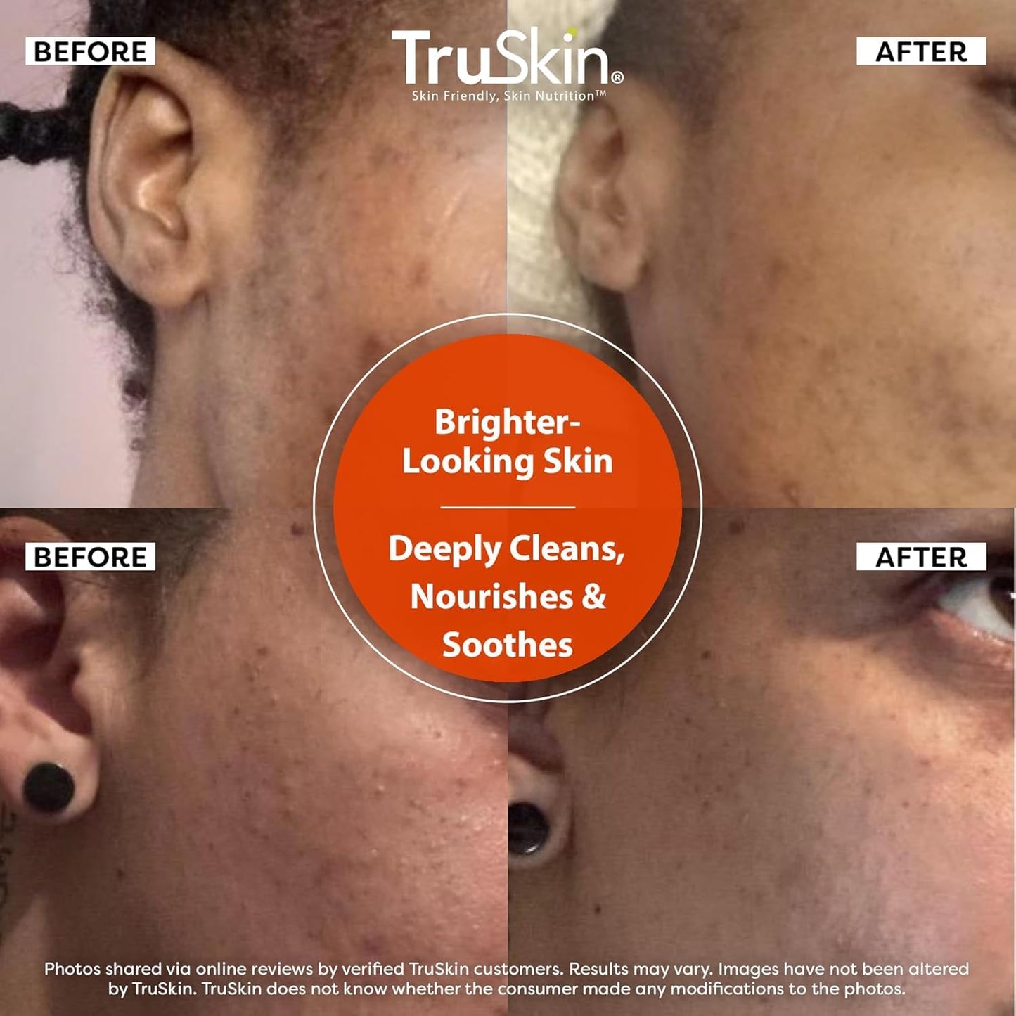 TruSkin Vitamin C Cleanser for Face - Brightening Face Wash with Vitamins C & E, Rosehip Oil, Aloe Vera and MSM - Deep Clean and Refresh for Radiant Beauty & Personal Care TruSkin
