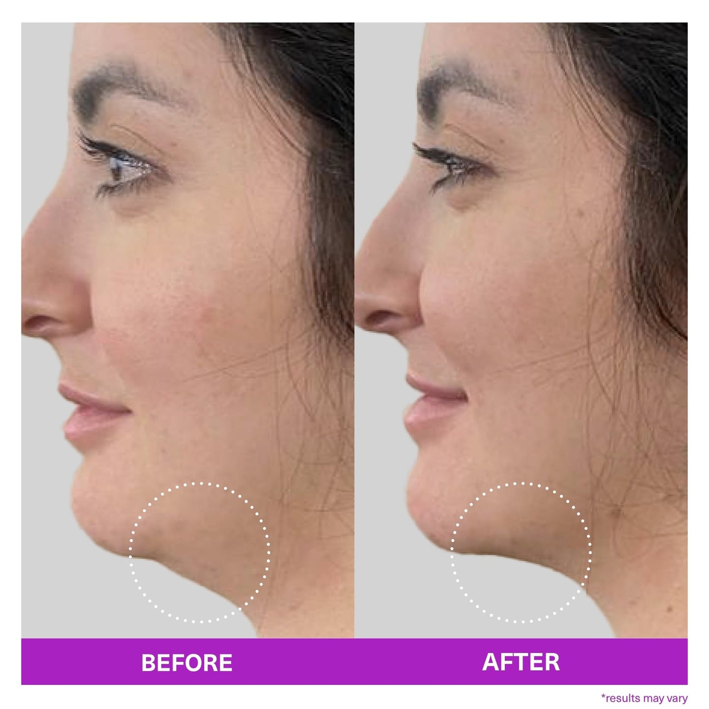 SickScience ShapeShift Advanced Jaw & Neck Firming Serum - Double Chin Reducer, Face Tightening Treatment with Exosome Technology to Lift Sagging Skin Beauty & Personal Care SickScience