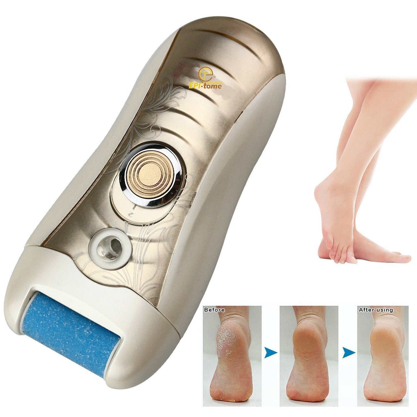 EPITOME Callus Remover Electric Ladies Shaver Dual Voltage Face & Body Epilator Beauty and Personal Care Epitome