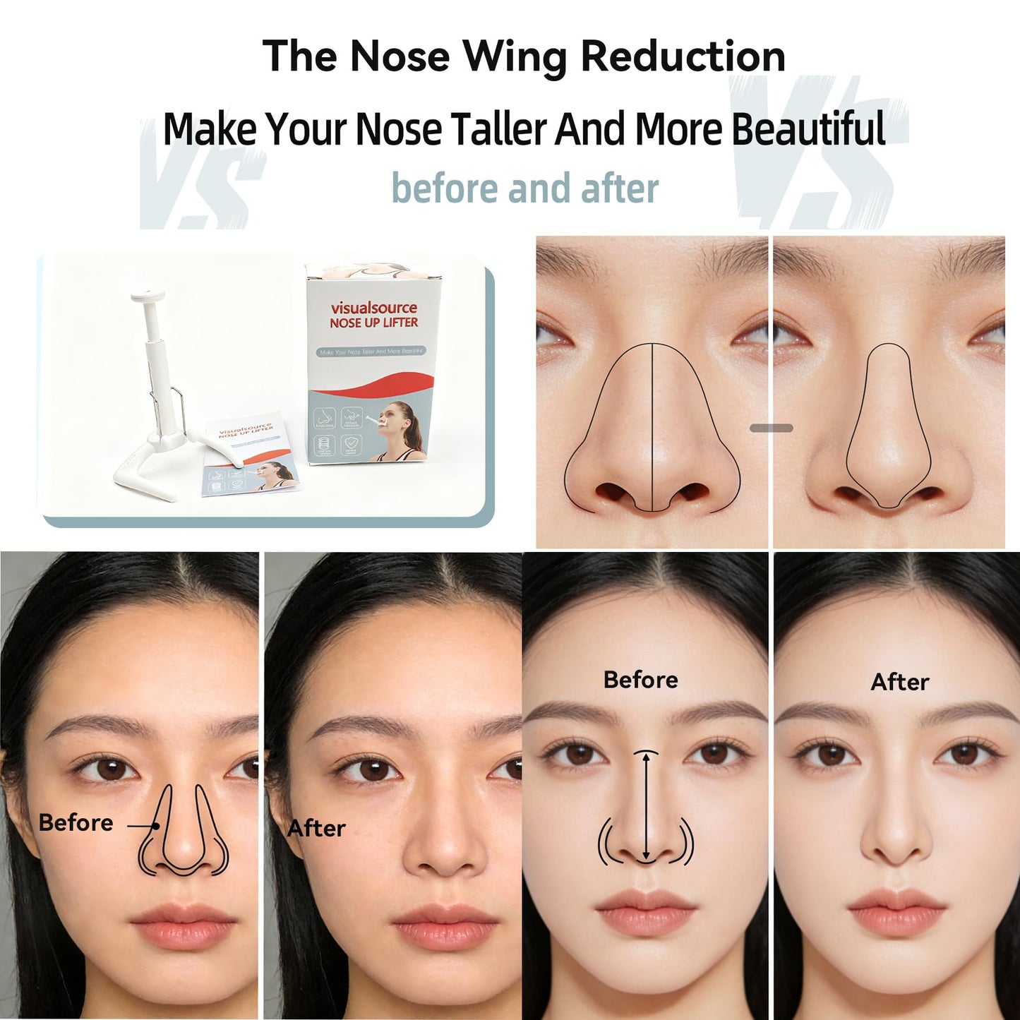 Nose Up Lifter Manufactured Nose Shaper Shaping For Wide Noses Slimmer Straightener Lifting Up Clip Beauty Device Up High Tool Lifting Adjustable Soft Beauty and Personal Care visualsource