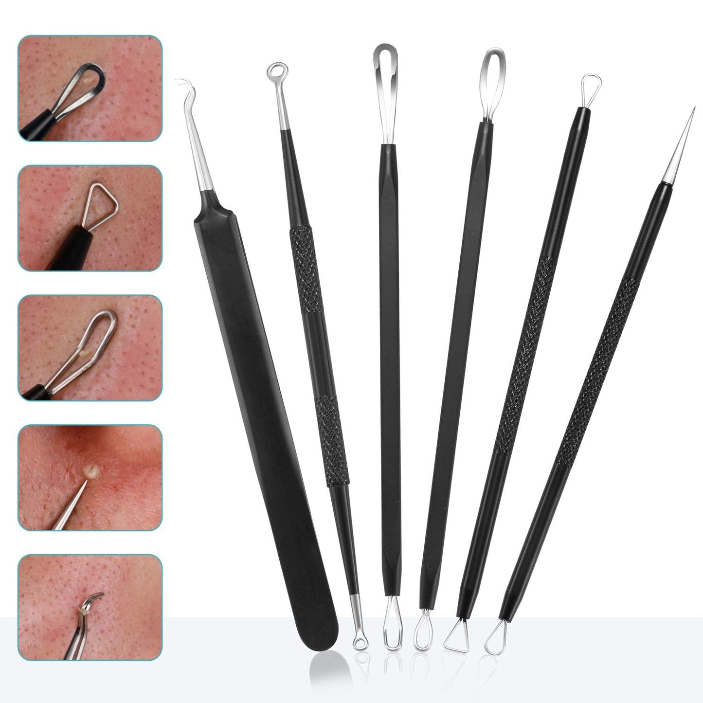 Blackhead Remover Pimple Popper Tool Kit - (6 Piece Kit) - Professional Stainless Pimples Comedone Extractor Removal Tool Beauty & Personal Care Tomata