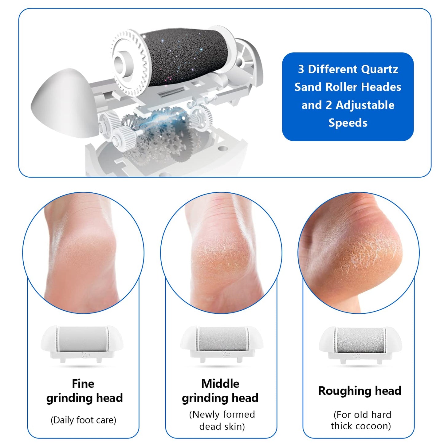 Electric Foot Callus Remover Kit, Elmchee Rechargeable Callous removers 3 Grinding Heads Waterproof Foot Scrubber File, Professional Pedicure Tools Beauty & Personal Care Elmchee