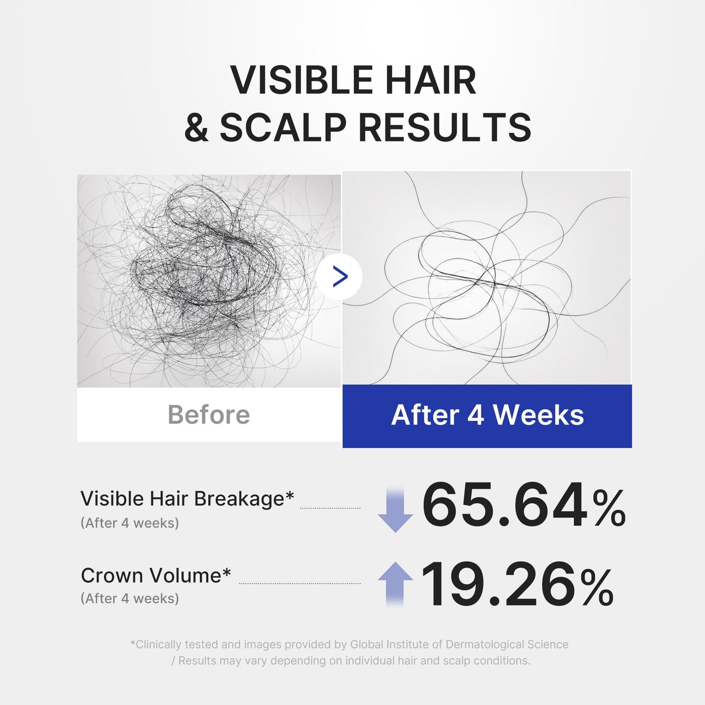 medicube Scalp Serum with Deoxyribose for Fuller Looking Hair Beauty and Personal Care medicube