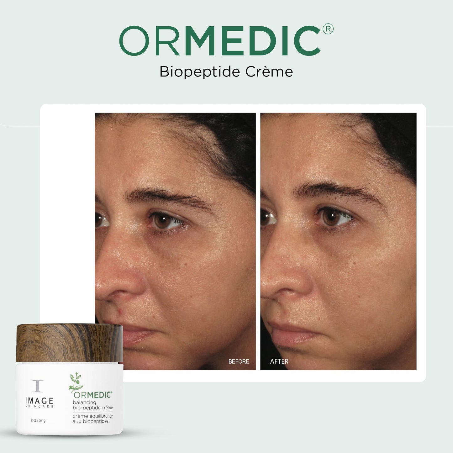 IMAGE Skincare, ORMEDIC Biopeptide Crème, Balancing Face Moisturizer with Shea Butter, Hyaluronic Acid and Organic Plant Oils, 2oz Beauty & Personal Care IMAGE Skincare
