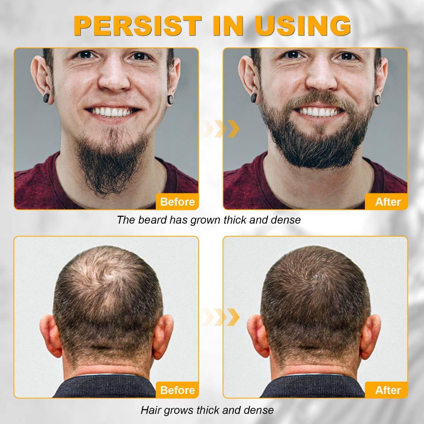 Beard Growth Kit - Beard Kit for Men, Beard Growth Oil (2oz), Beard Balm, Beard Comb, Massager for Spot/Patchy Beard - Christmas, Anniversary Beauty & Personal Care Mideand