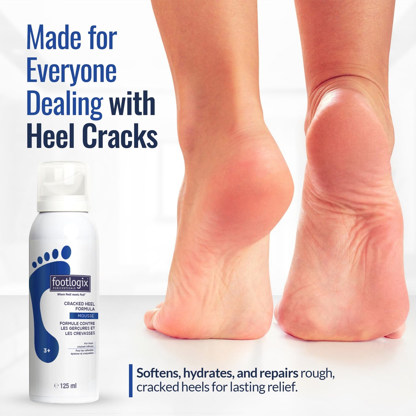 FOOTLOGIX Cracked Heel Formula, White 4.23 Ounce Beauty & Personal Care FOOTLOGIX