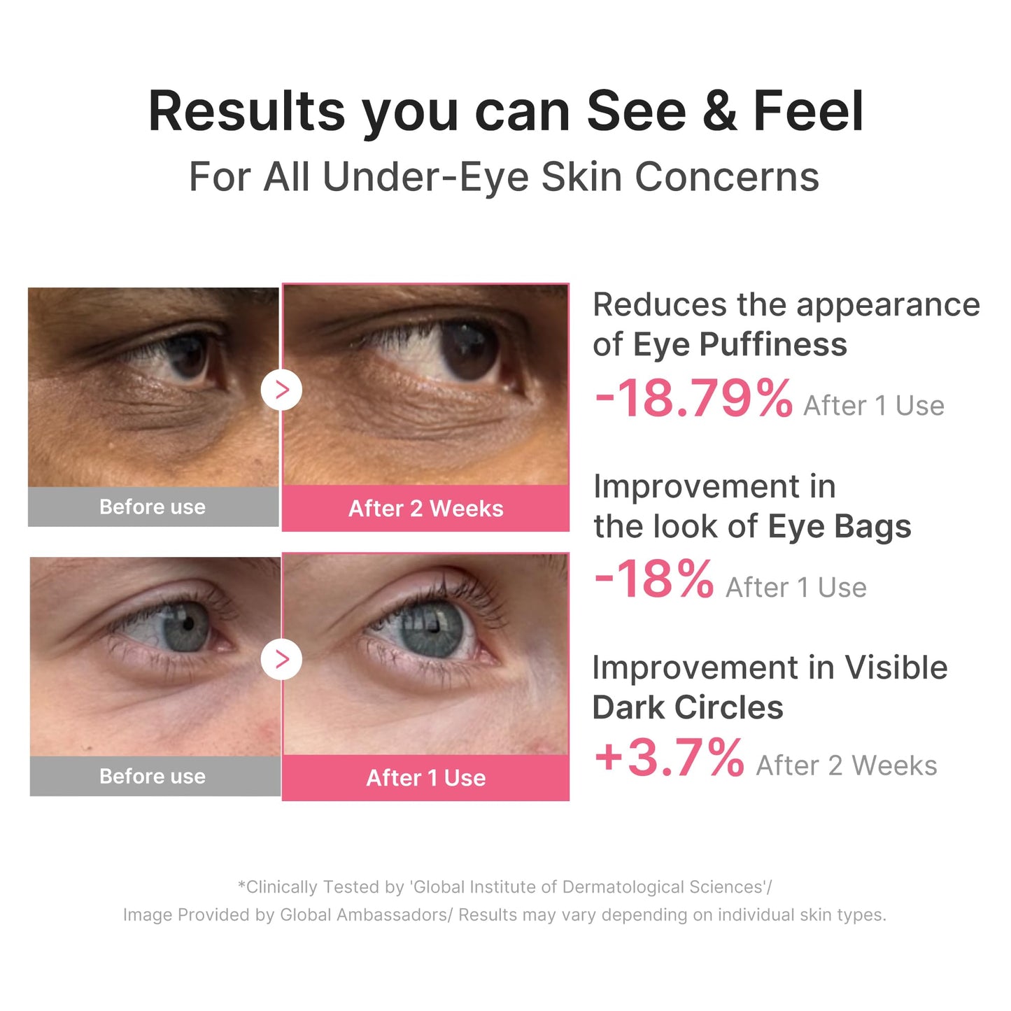 medicube Eye Patch PDRN Caffeine Collagen | Gel Eye Patches for the appearance of Dark Circles, Undereye Bags | Firming, Age-Defying Care Beauty and Personal Care medicube