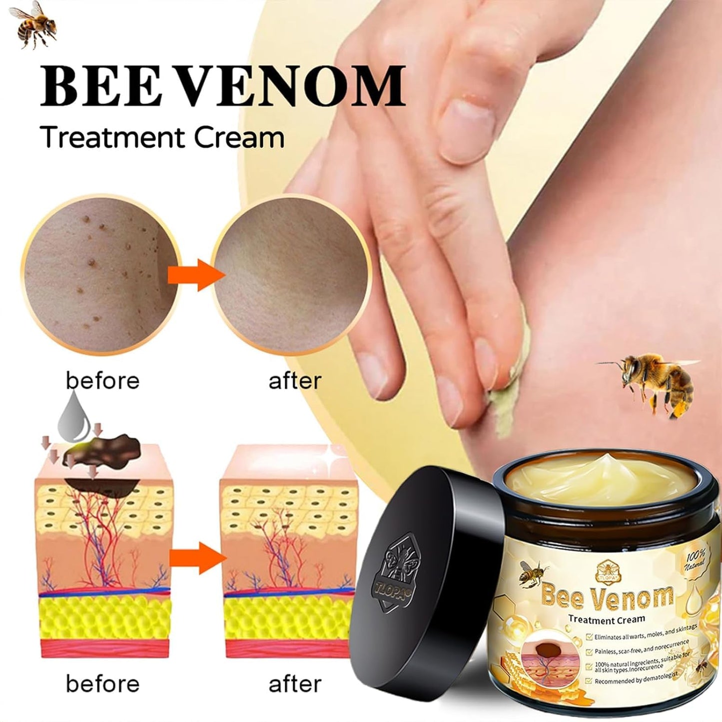 Bee Venom Skin Treatment Cream, 2024 New Bee Venom Repair Cream, Professional Bee Venom Cream-30g, Repair Maximum Strength for All Skin Types (1 Beauty & Personal Care AEEHFENG