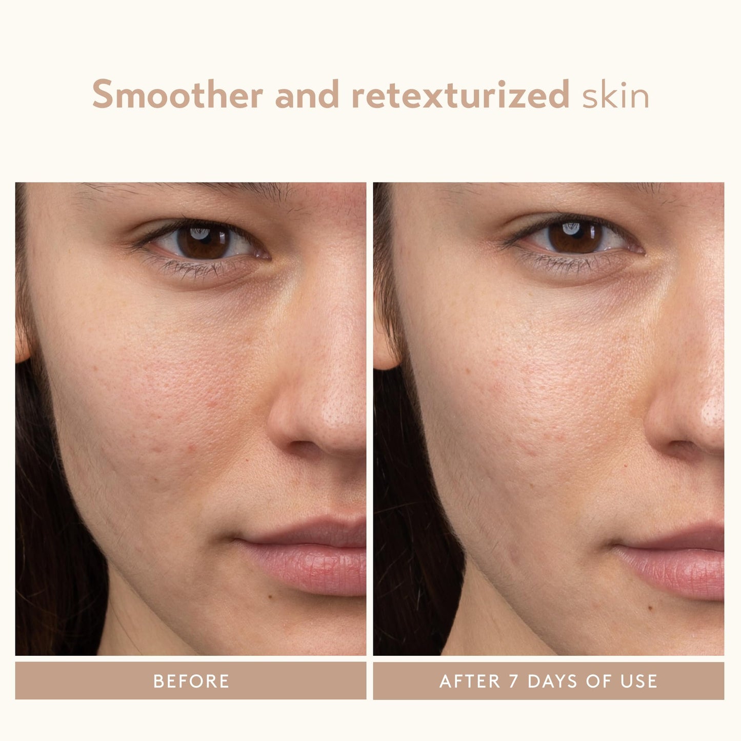 SHANI DARDEN SKIN CARE Lactic Acid Face Serum, Active Night Serum to Help with the Look of Radiant and Smooth Skin, Gentle But Powerful Face Beauty & Personal Care SHANI DARDEN