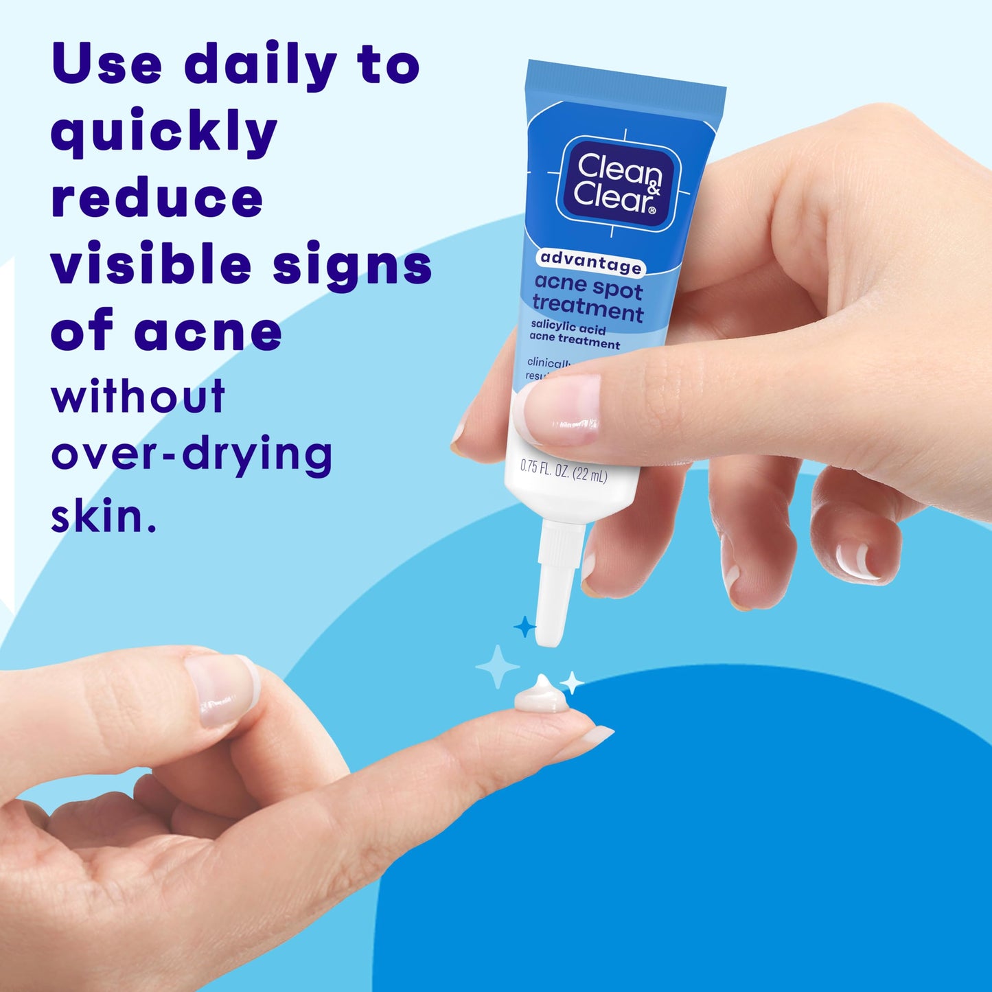 Clean and Clear Advantage Acne Spot Treatment Gel Cream with 2% Salicylic Acid & Witch Hazel, Acne Pimple Medication for Blemish & Blackhead Removal Beauty & Personal Care Clean & Clear