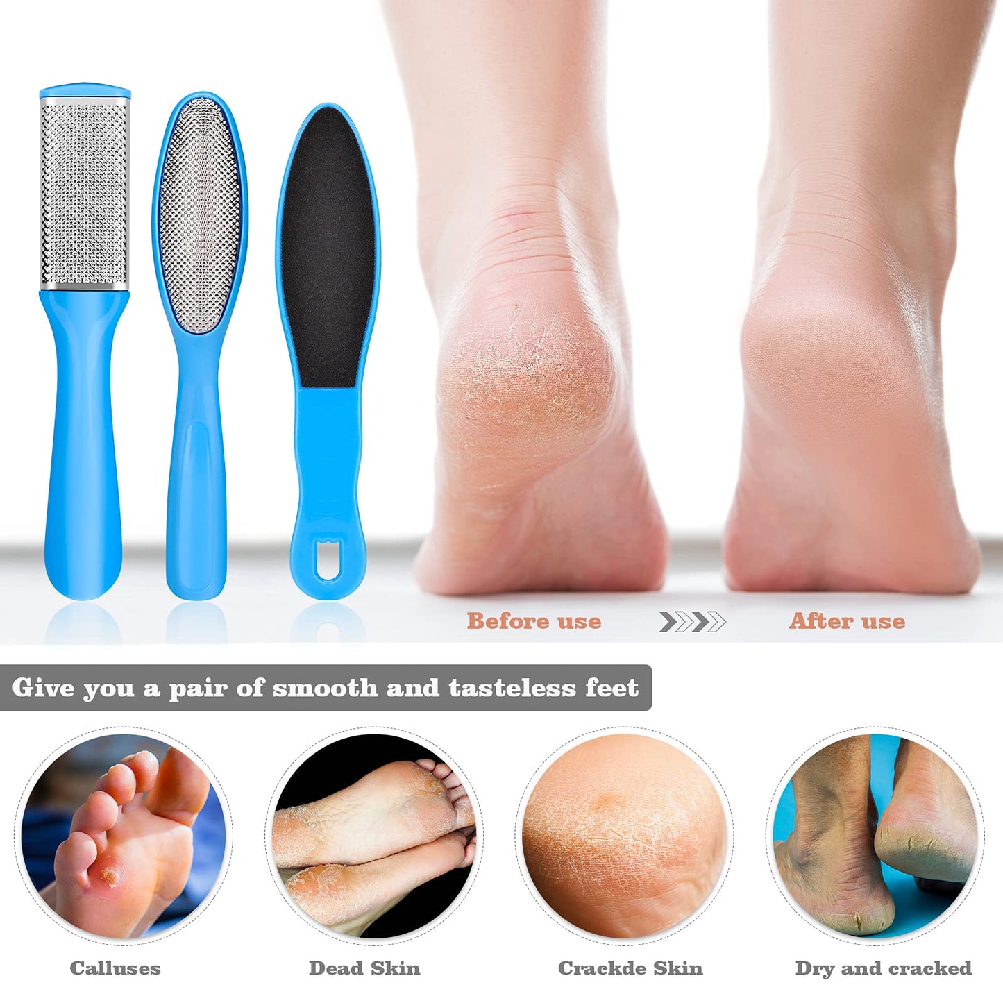 Pedicure Kits - Callus Remover for Feet, 23 in 1 Professional Manicure Set Pedicure Tools Stainless Steel Foot Care, Foot File Foot Rasp Dead Skin Beauty & Personal Care FINTOZER