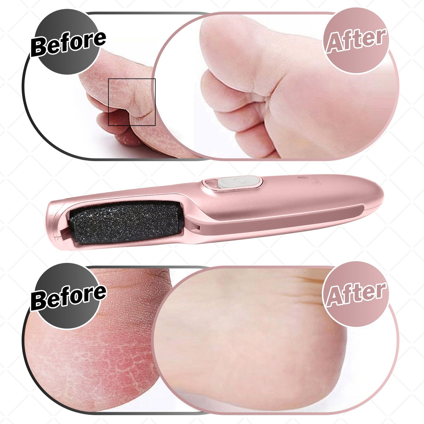 Powerful Electric Callus Remover Wand - Rechargeable Foot File, Grinder & Scrubber - Removes Dead, Hard Skin & Calluses - Best Pedicure Tool for Soft Beauty & Personal Care Care me