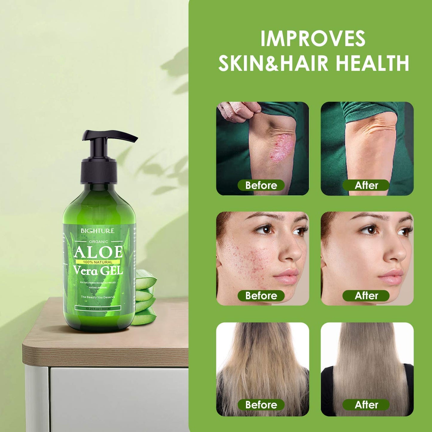 BIGHTURE Aloe Vera Gel, 100% Aloe Vera from Freshly Cut Aloe Leaves, Skin Care for Deeply & Rapidly Soothing, Firming, After Shave, Sunburn Relieve Beauty & Personal Care BIGHTURE