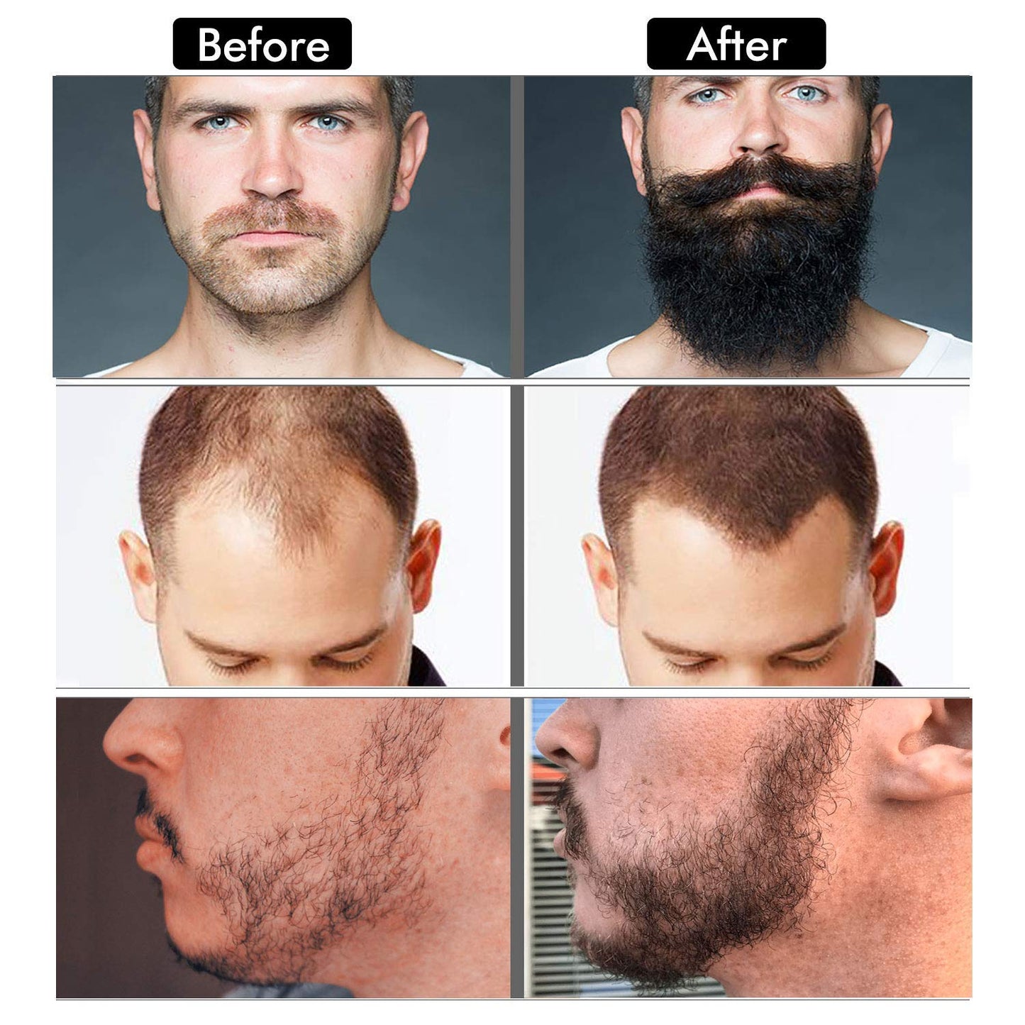 Beard Growth Kit - Beard Kit for Men, Beard Growth Oil (2oz), Beard Balm, Beard Comb, Massager for Spot/Patchy Beard - Christmas, Anniversary Beauty & Personal Care Mideand