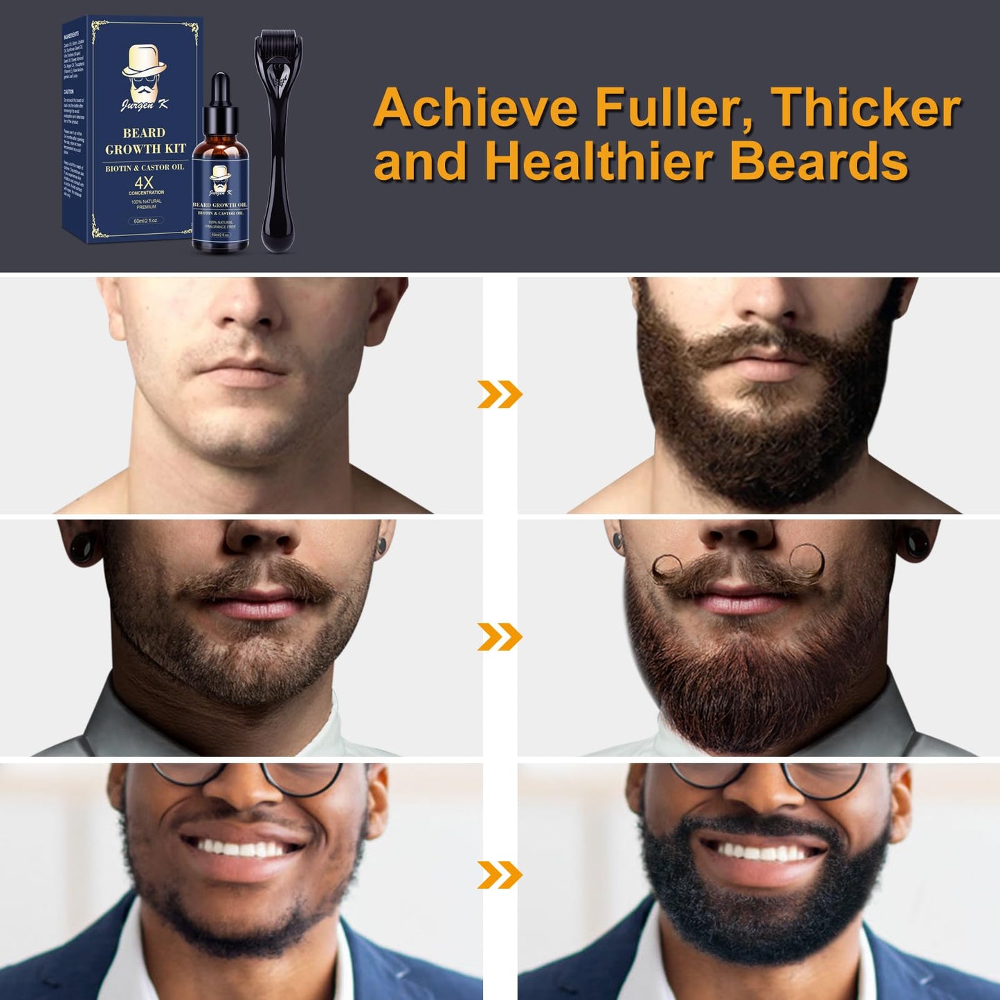 Beard Growth Kit, Beard Growth Oil (2Oz) w/Biotin & Castor Oil, Beard Massager for Patchy/Spot Beard, Beard Kit for Men's Grooming, Dad Day Gifts Beauty and Personal Care Jurgen K