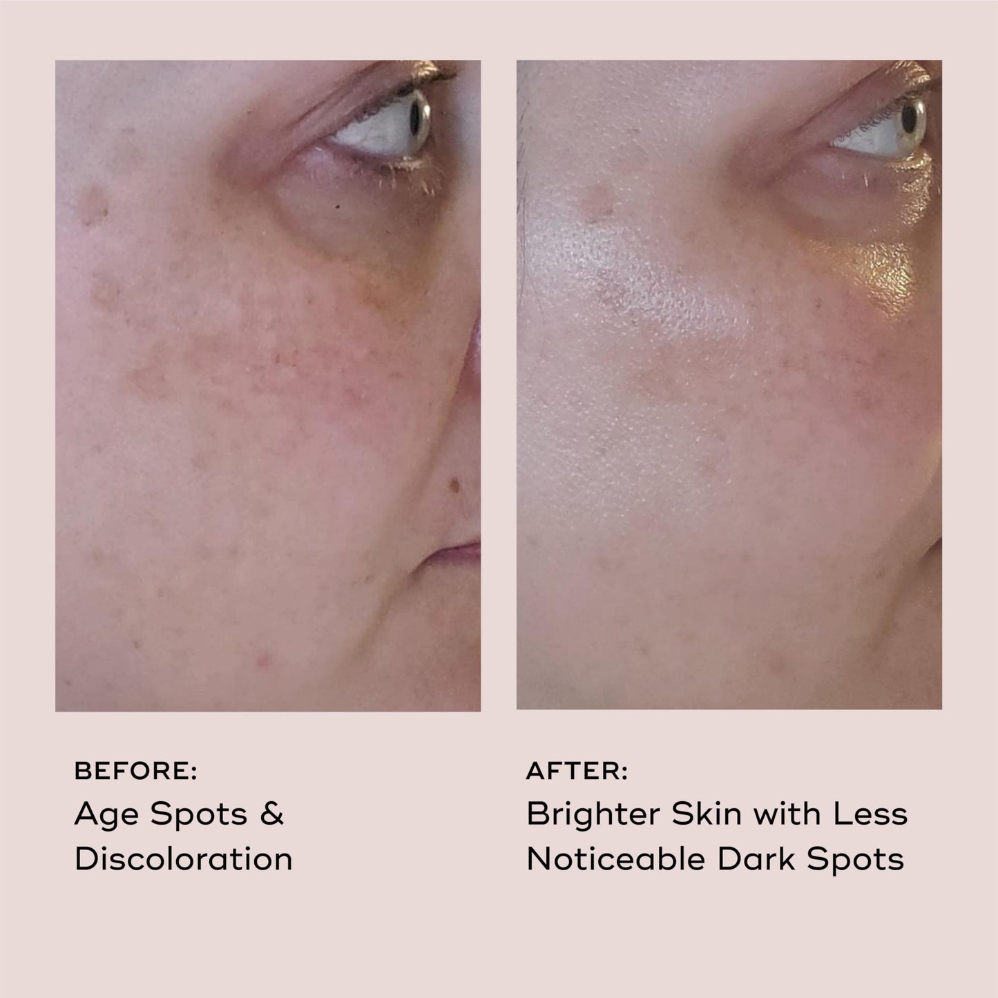 EVER Vitamin C Dark Spot Correcting Serum for Face - Anti Aging & Brightening Serum with 10% Vitamin C, Helps Fade Dark Spots, Age Spots & Uneven Tone Beauty & Personal Care EVER