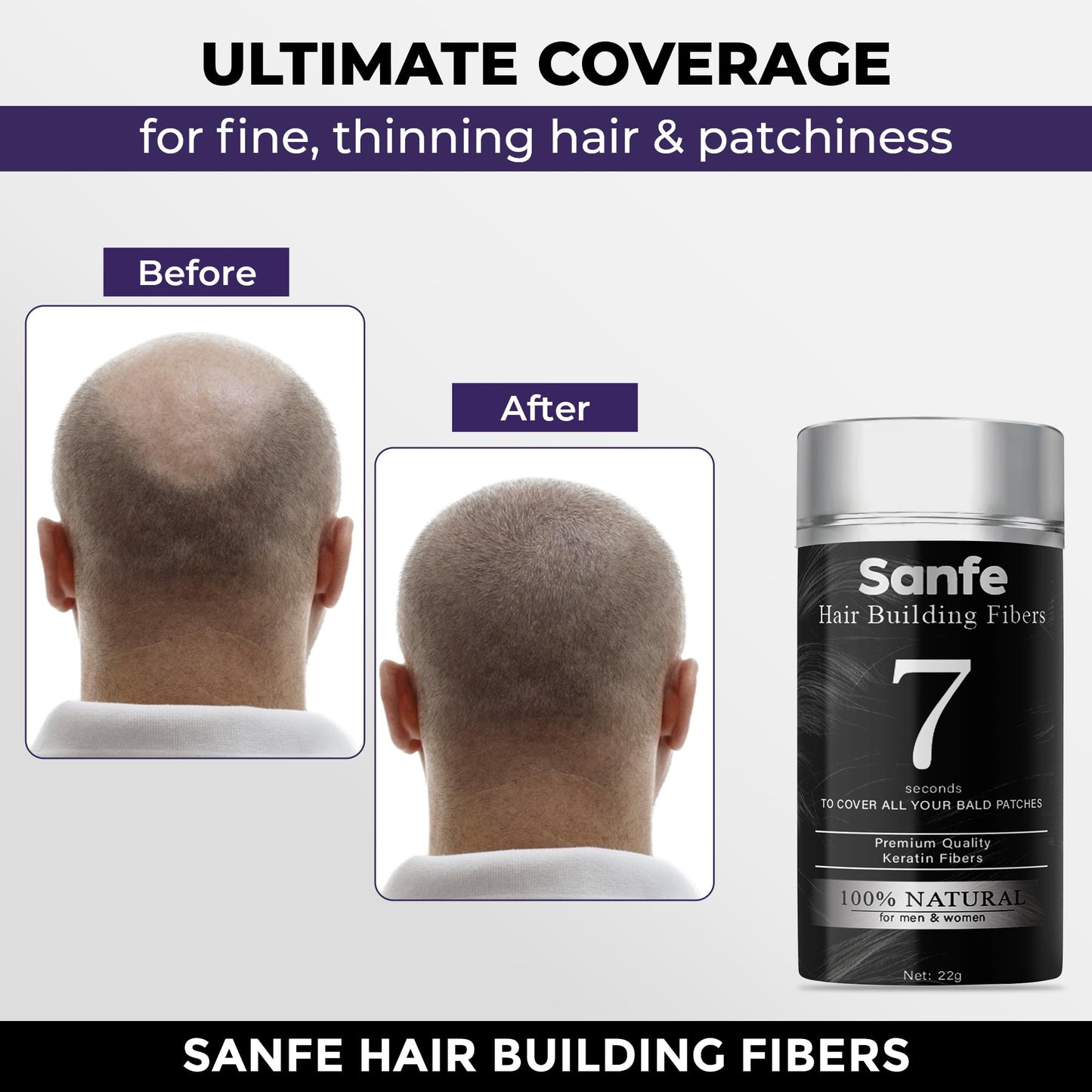Sanfe Instant Bald Spot Covering Fibers- 22g Beauty and Personal Care Sanfe