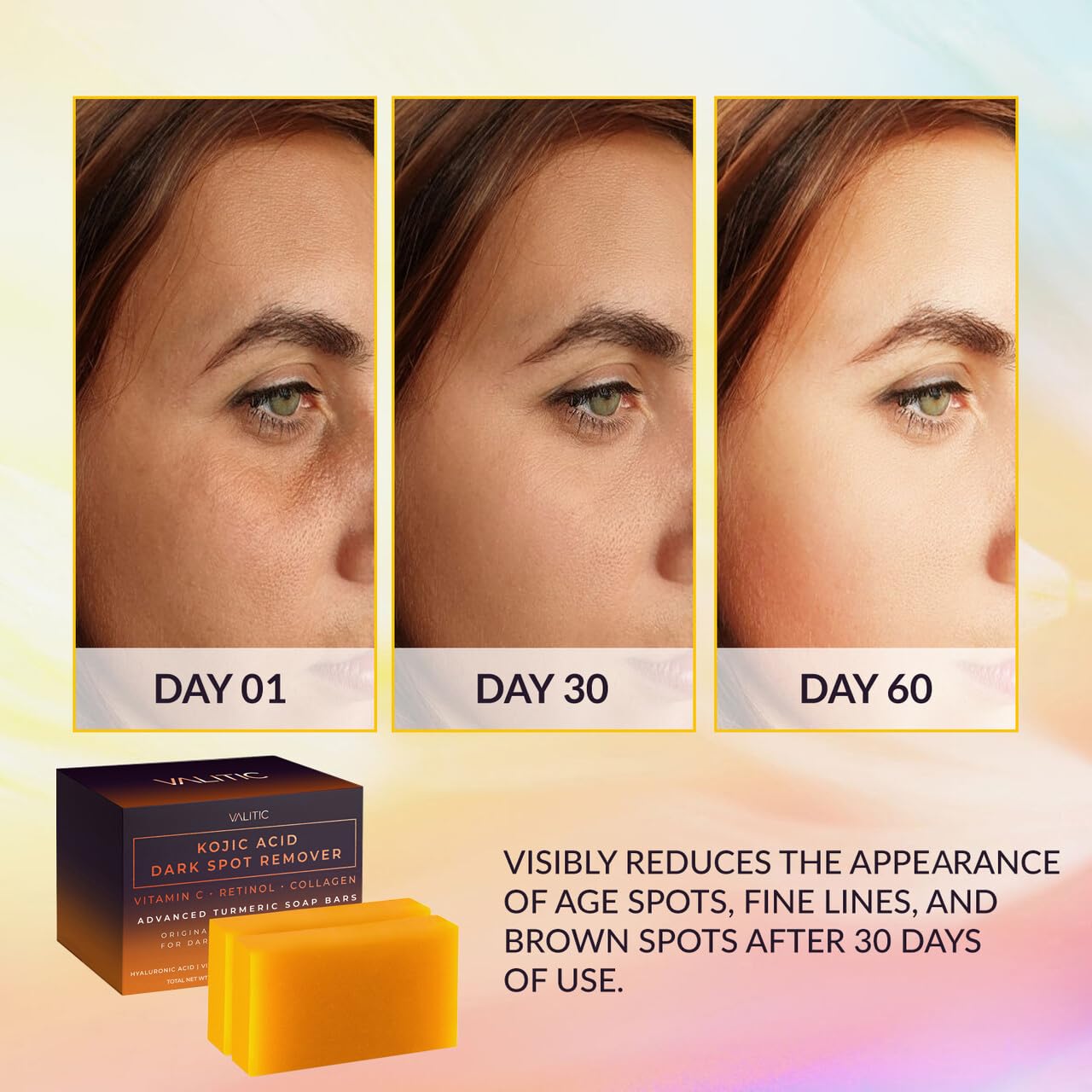 VALITIC Kojic Acid Dark Spot Remover Soap Bars with Vitamin C, Retinol, Collagen, Turmeric - Original Japanese Complex Infused with Hyaluronic Acid Beauty & Personal Care VALITIC