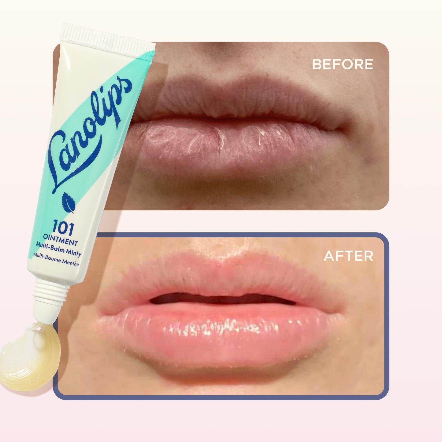 Lanolin 101 Multipurpose Ointment - Lanolin Lip Balm & Healing Ointment for Skin Barrier Repair - Moisturizer for Dry Lips, Cuticles & Elbows - No Beauty and Personal Care Lanolips