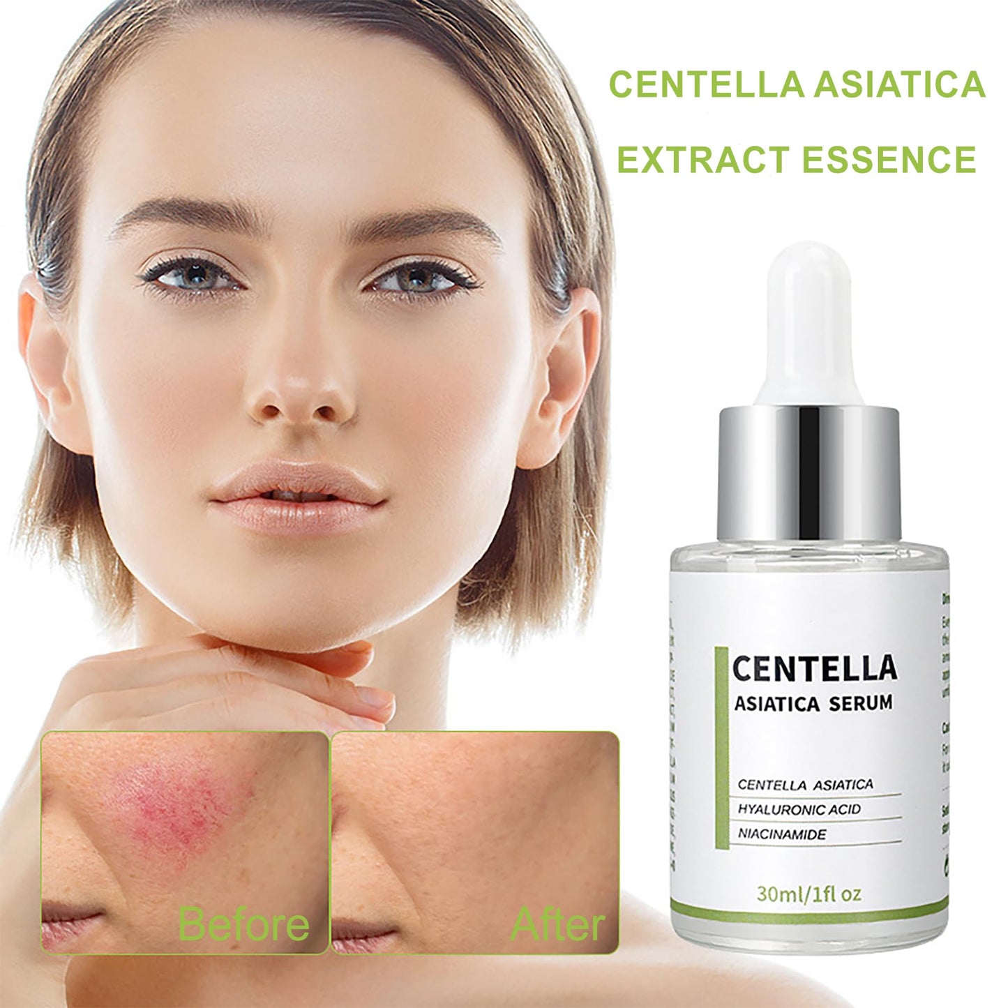 Centella Asiatica Soothing Redness Serum,Facial Serum For Troubled & Sensitive Skin-Including Chamomile Extract, Niacinamide,Aloe Vera Leaf Beauty & Personal Care XFXS
