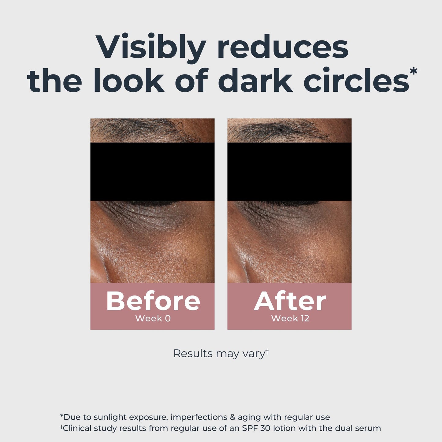 Eucerin Radiant Tone Eye Cream Dark Circle Corrector, Eye Brightening Cream with Thiamidol and Hyaluronic Acid, Helps Reduce the Look of Eye Beauty & Personal Care Eucerin