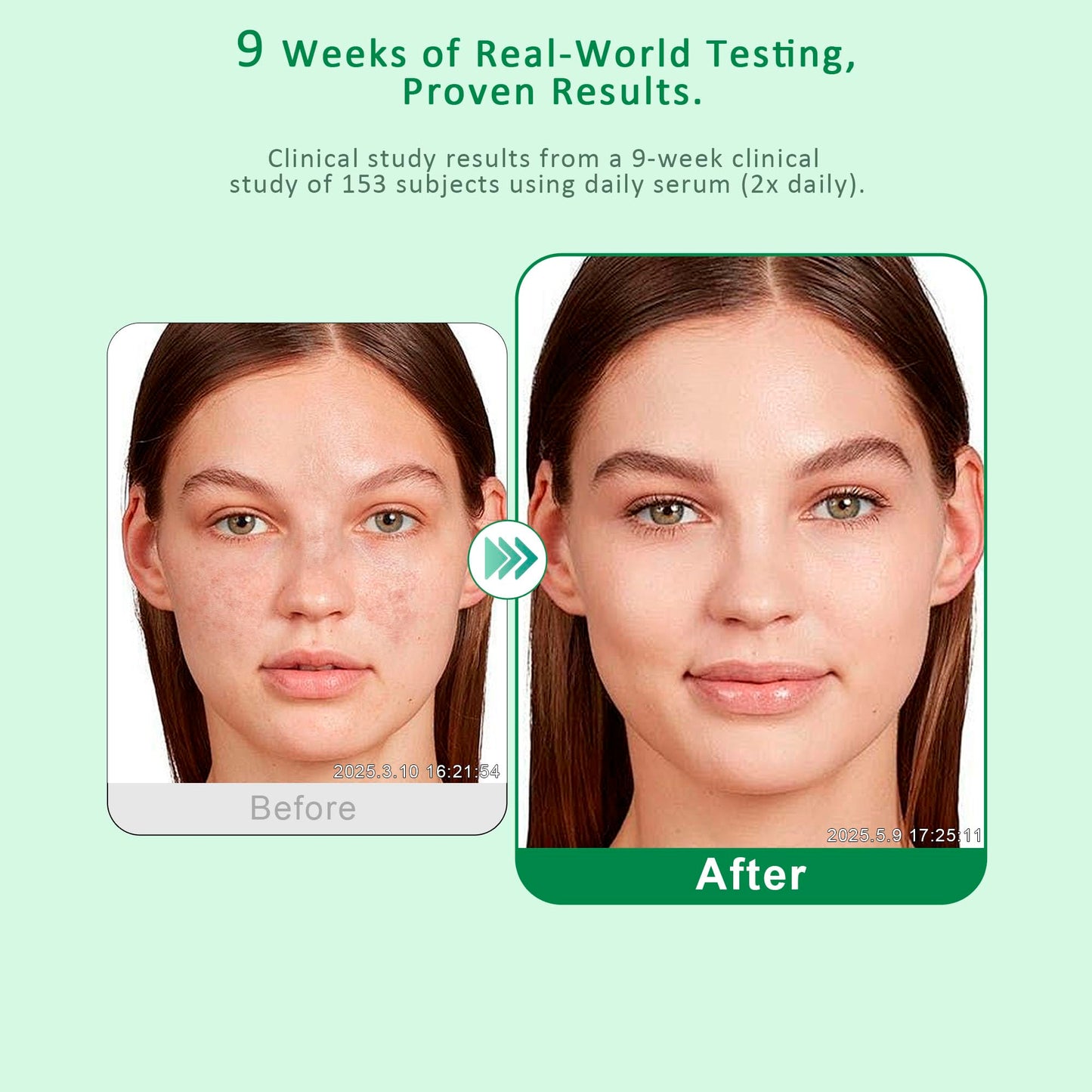 Dark Spot Remover for Face & Body - Dark Spot Corrector Serum for Hyperpigmentation, Brown Spots & Melasma Treatment - 1.7 fl oz Beauty & Personal Care VBBV