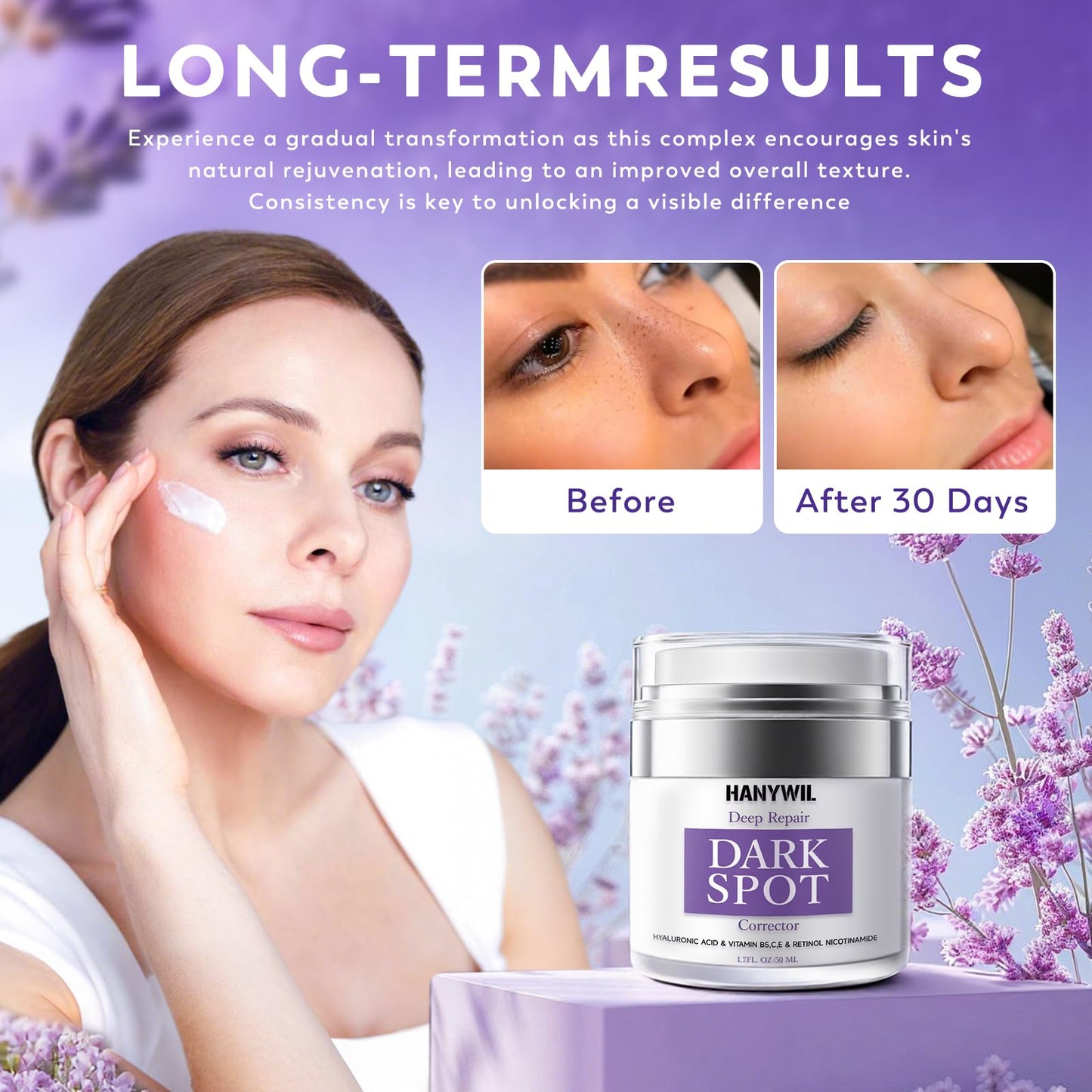 HANYWIL Dark Spot Remover for Face & Body, Remedy for Dark Spots with Natural Ingredients, Dark Spot Corrector Cream and Serum for Skin Care, Treats Beauty & Personal Care HANYWIL