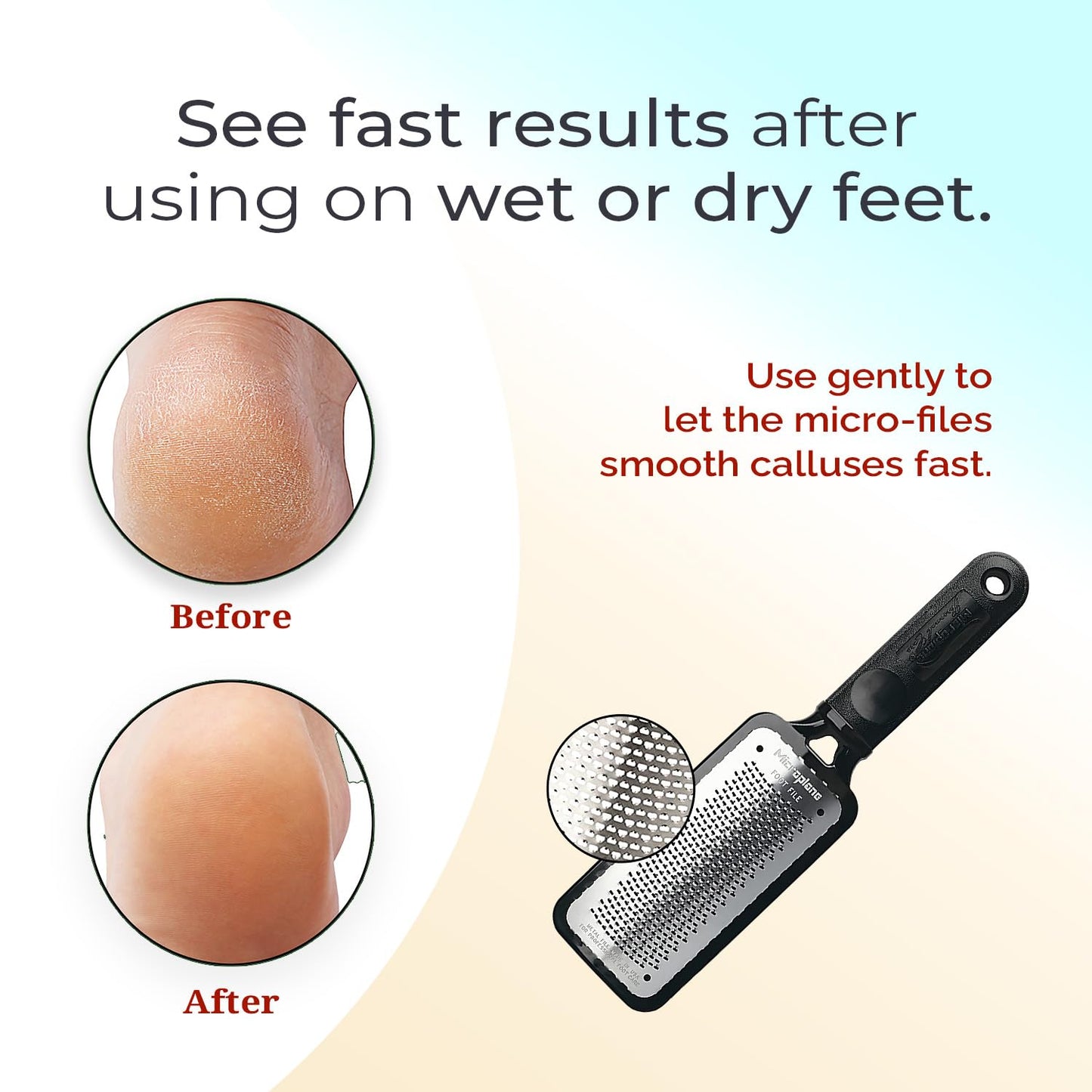 Microplane Colossal Foot File Scraper - The Original Stainless Steel Foot Rasp, Dead Skin/Callus Remover for Feet, Gentle Foot Scrubber, Pedicure Beauty & Personal Care Microplane