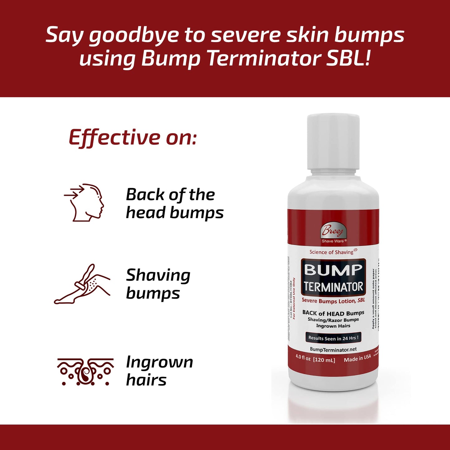 BREEJ Bump Terminator Severe Bumps Lotion (4oz) Beauty and Personal Care BREEJ