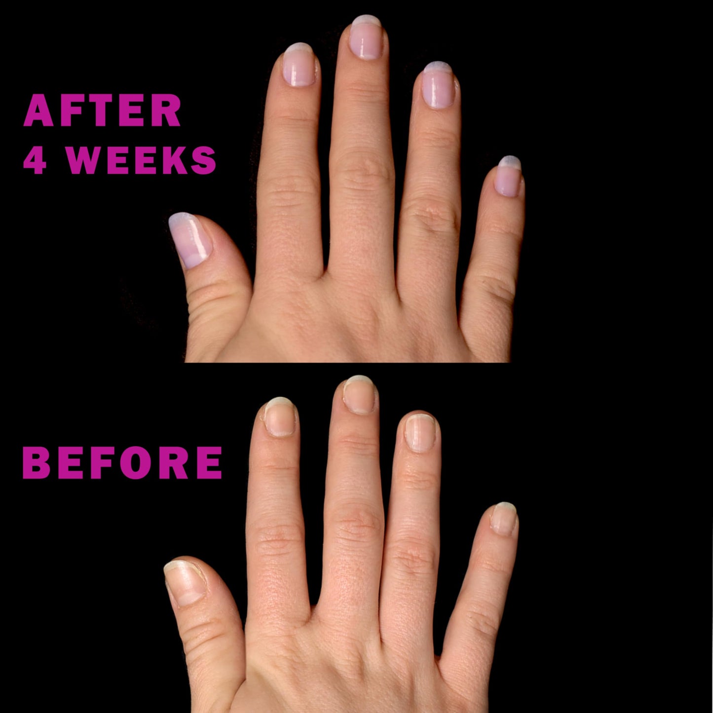 Perfect Formula Pink Gel Coat - Rosey Glow Nail Strengthener & Keratin Treatment, 0.6 oz - Protein-Rich, Glossy Pink Gel Nail Polish for Damaged Nails Beauty & Personal Care Perfect Formula