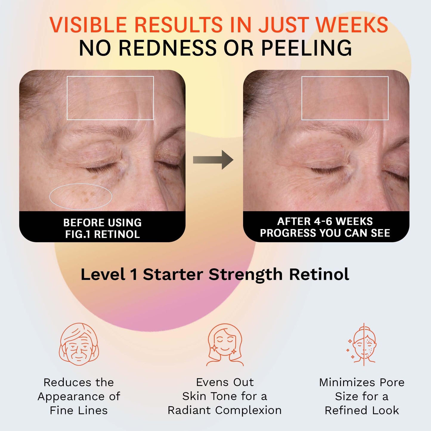 Fig.1 Retinol Night Cream | Face Hydrating Moisturizer With Retinol & Squalane | Night Cream For Women With Sensitive Skin | Dermatologist Tested Beauty & Personal Care Fig.1
