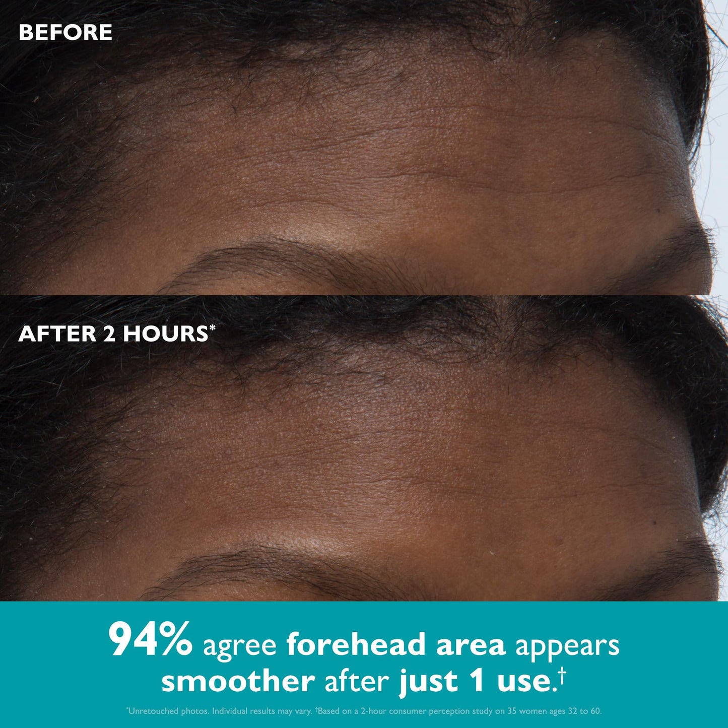 Peter Thomas Roth | Peptide Skinjection™ Peptide-Infused Face & Eye Tape | Face Tape For Wrinkles and Aging Skin | Peptide Face Tape Beauty and Personal Care Peter Thomas Roth