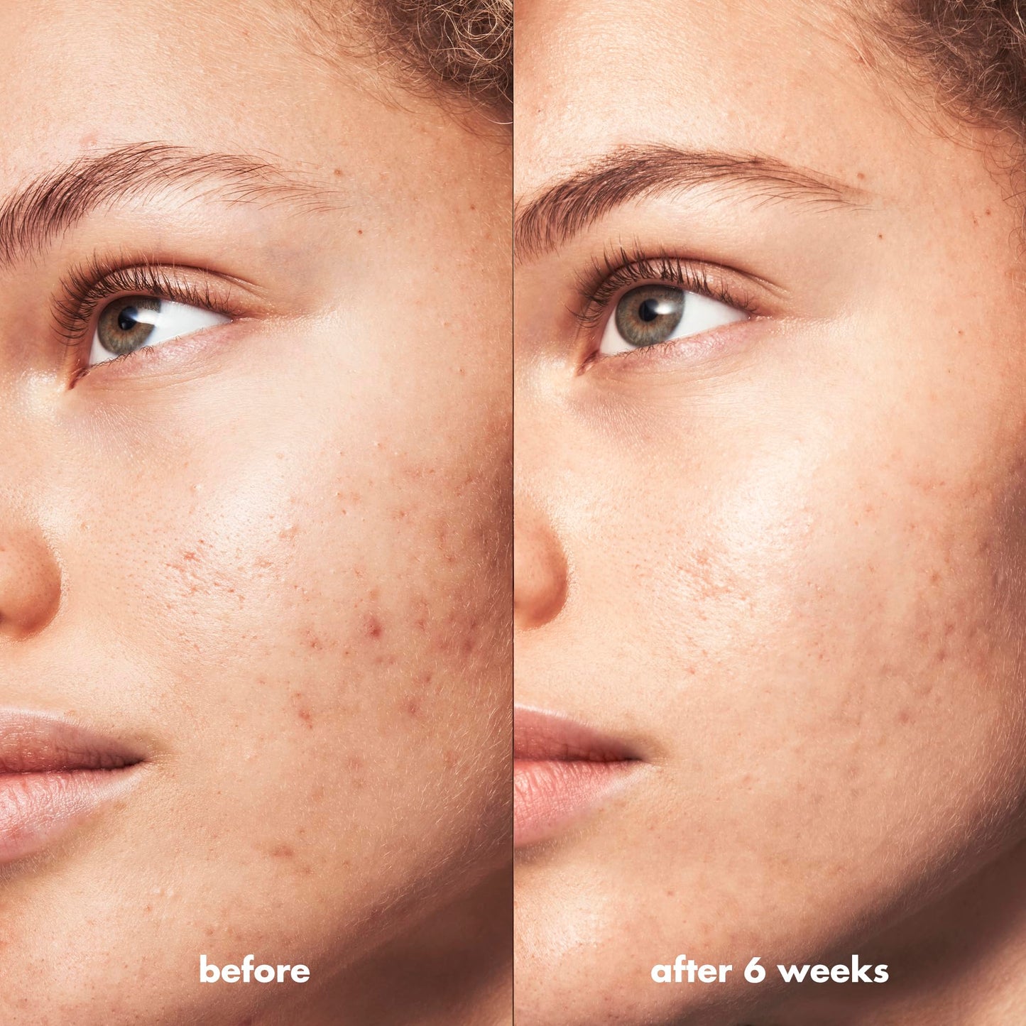 e.l.f. SKIN Blemish Breakthrough Clarifying Cleanser Mini, Gel Cleanser For Removing Makeup, Controlling Oil & Clarifying Pores, 1% Salicylic Acid Beauty & Personal Care e.l.f.