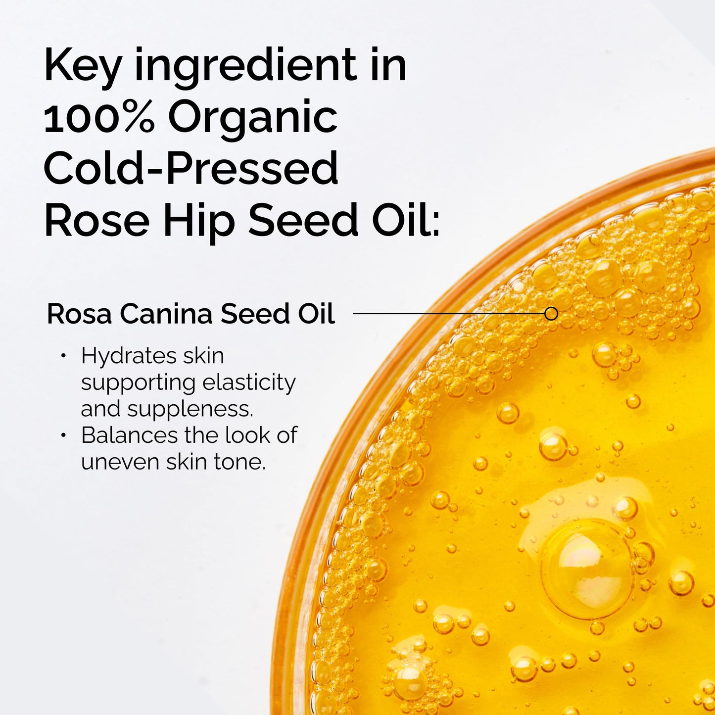 The Ordinary 100% Organic Cold-Pressed Rose Hip Seed Oil, Addresses Signs of Aging by Improving the Appearance of Uneven Skin Tone, Supporting Skin Beauty & Personal Care The Ordinary