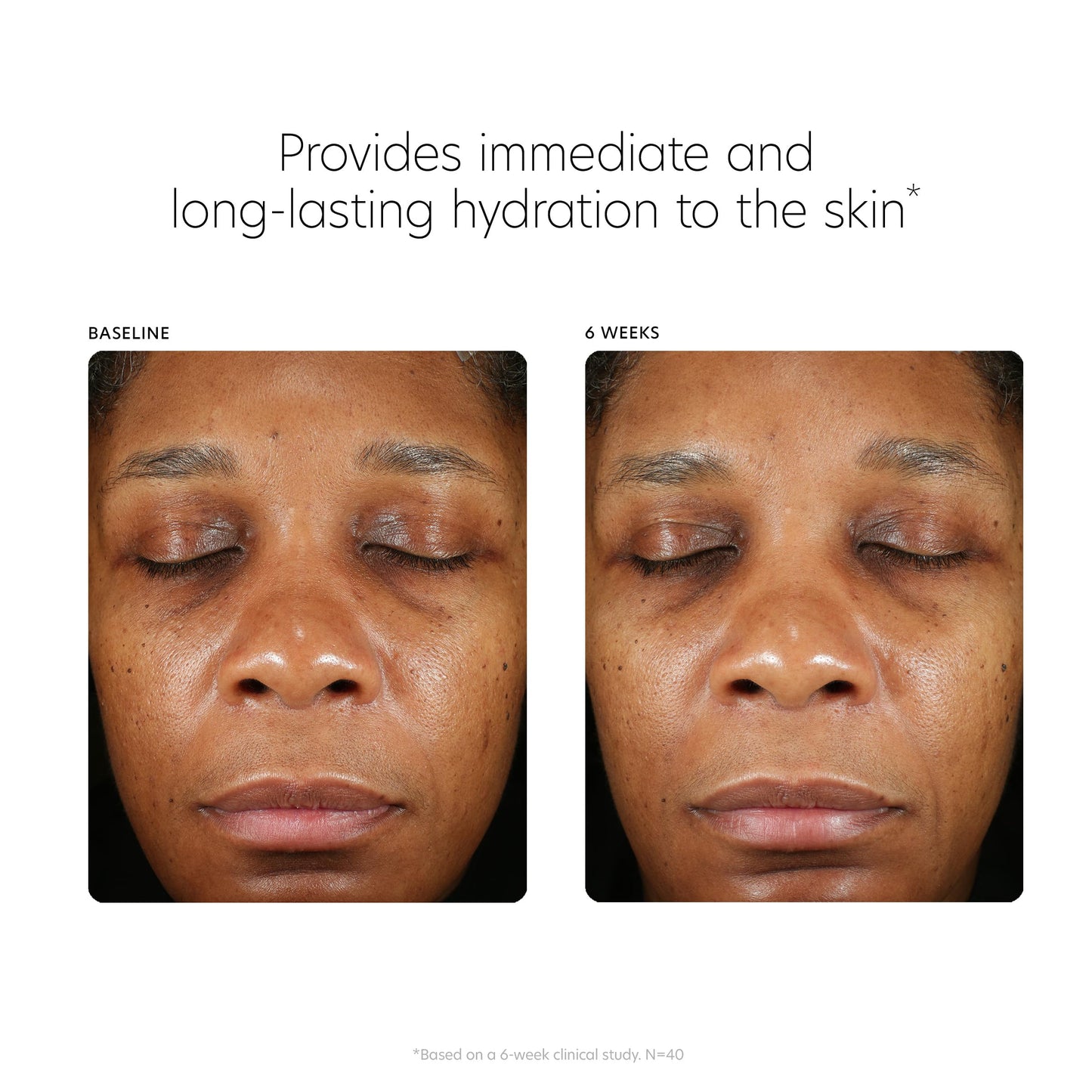 PCA SKIN Hyaluronic Acid Boosting Face Serum - Anti Aging Hydrating Facial Corrector with Niacinamide for Smoothing Wrinkles & Fine Lines (3 fl oz) Beauty & Personal Care PCA SKIN
