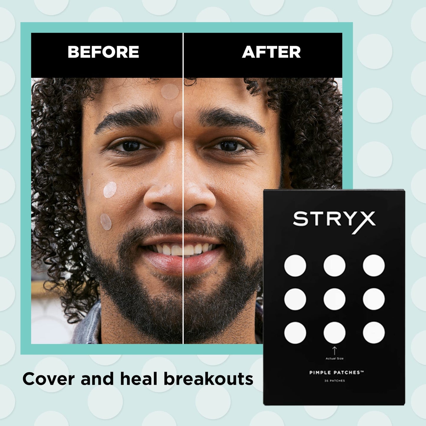 Stryx Hydrocolloid Acne Pimple Patches for Men, 3-Pack - Great for Breakouts, Zits, Blemishes, Whiteheads, & Reducing Redness - Designed for Men’s Beauty & Personal Care Stryx