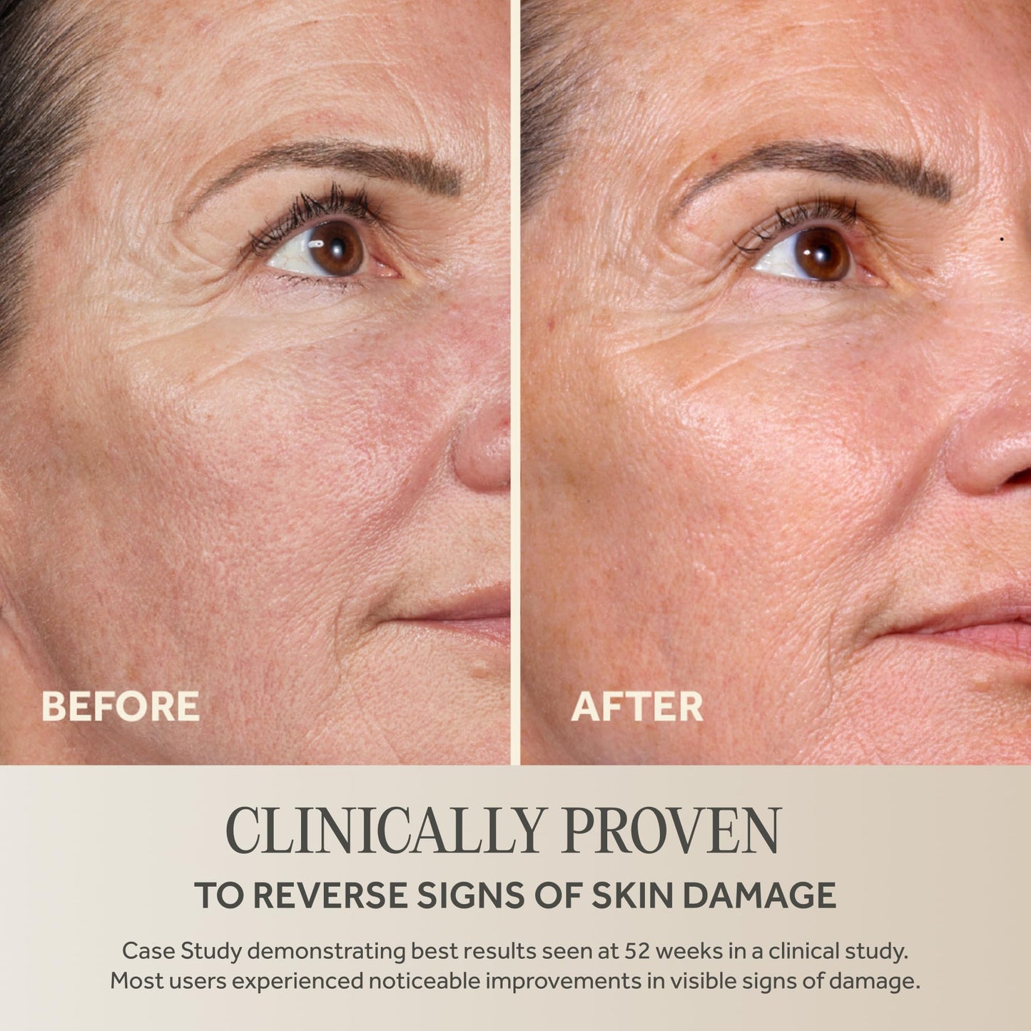 No7 Future Renew Damage Reversal Face Serum - Fast-Absorbing Peptide Serum to Help Visibly Reduce Fine Lines & Wrinkles - Enriched with Hyaluronic Beauty and Personal Care No7