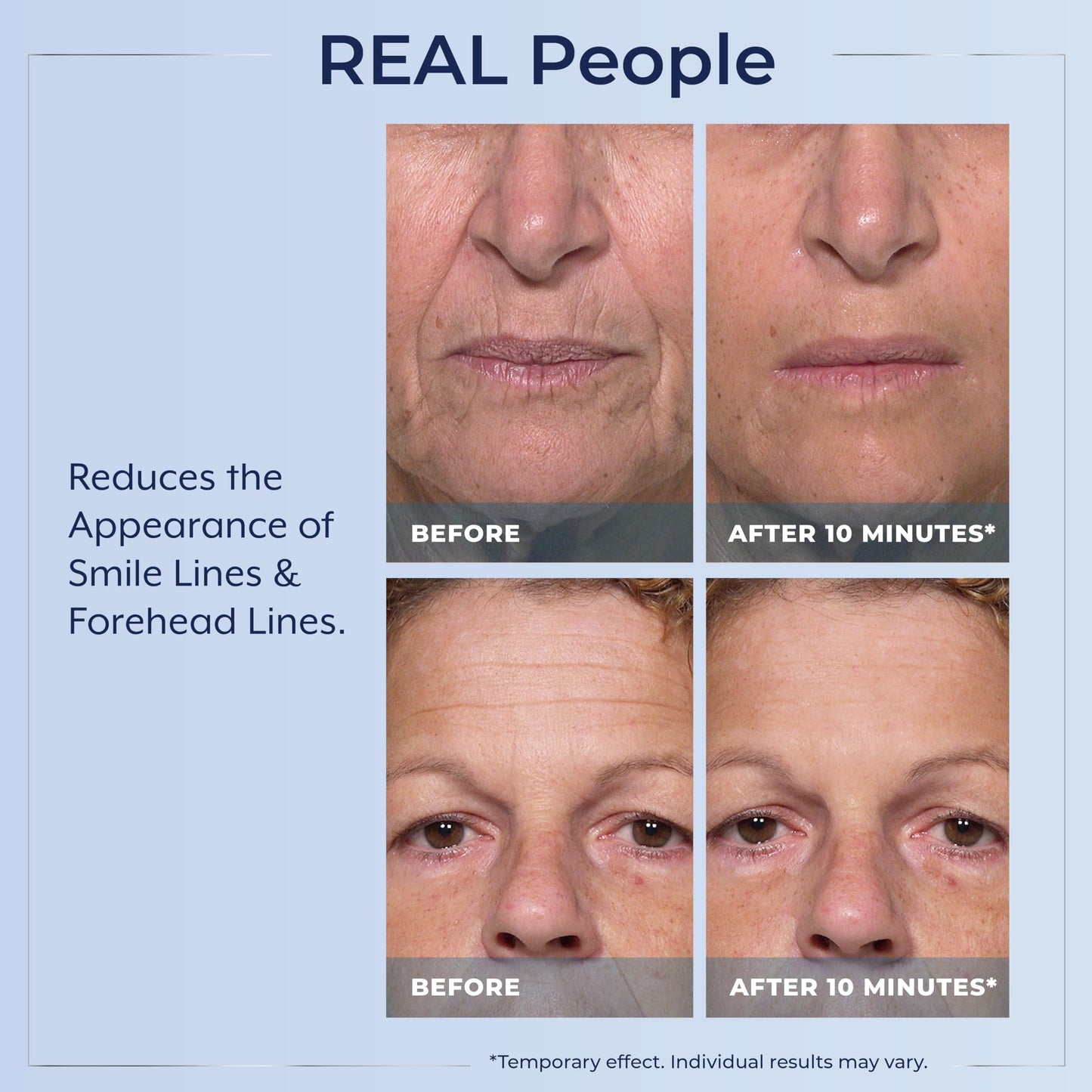Plexaderm Rapid Reduction Eye Serum - Visibly Reduces Under-Eye Bags, Wrinkles, Dark Circles, Fine Lines & Crow's Feet Instantly, Anti Aging Wrinkle Beauty & Personal Care Plexaderm