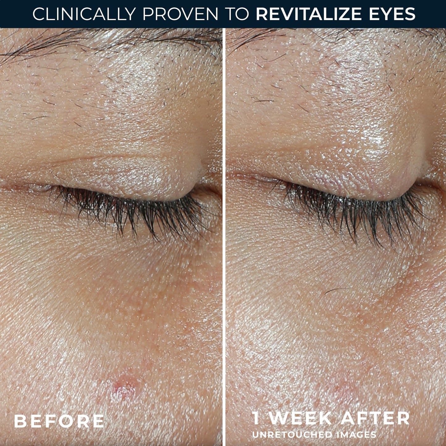 RoC Multi Correxion Revive + Glow Eye Balm with Vitamin C (0.14 oz) + Retinol Eye Cream Packette Beauty & Personal Care RoC