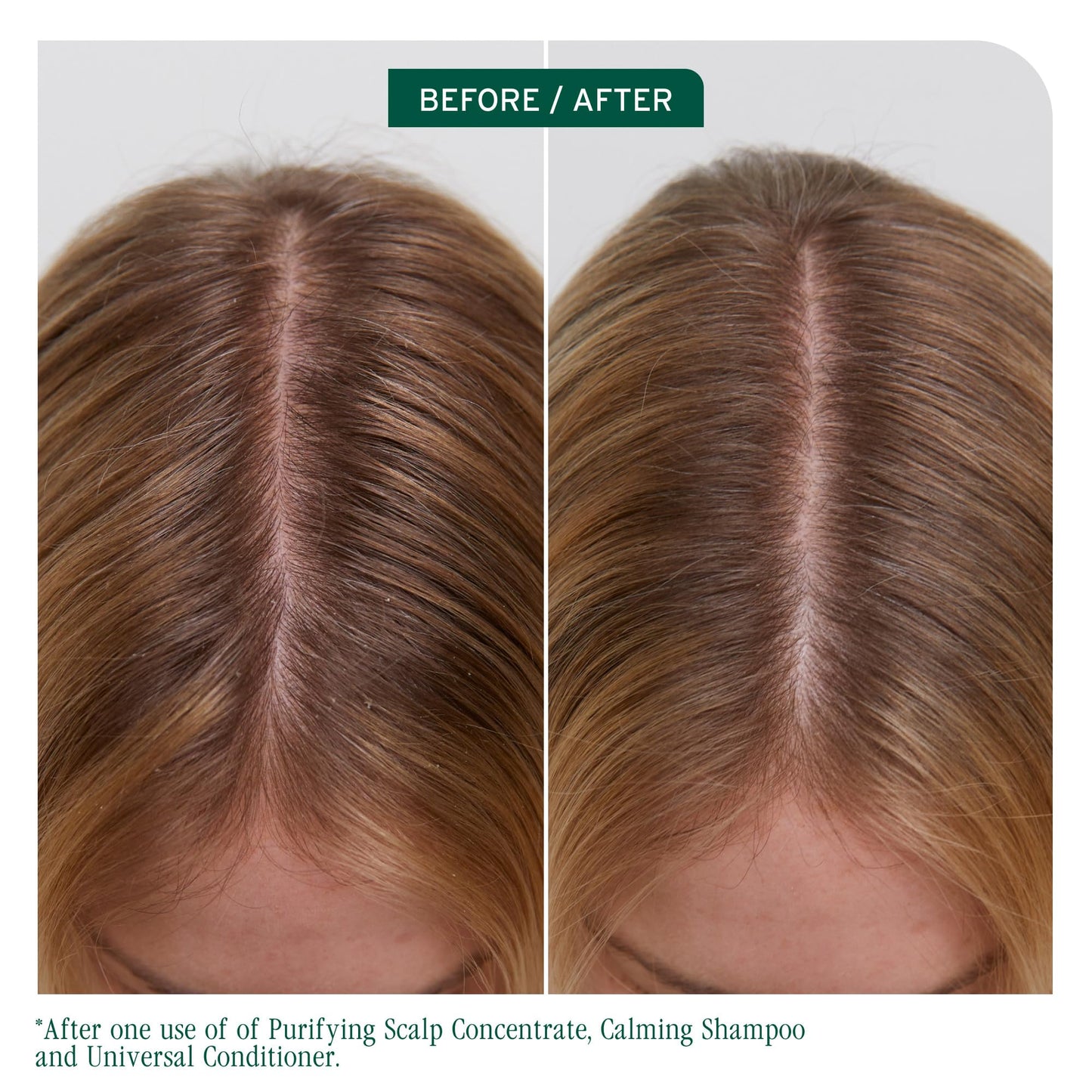 Biolage Scalp Sync Universal Conditioner - Nourishing & Hydrating for All Scalp Types, Lightweight Moisturizing & Conditioning, Fermented Tea Blend Beauty & Personal Care Biolage