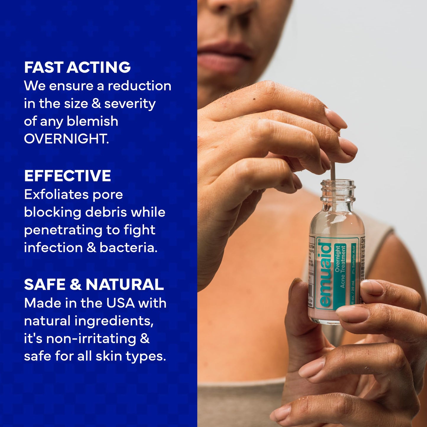 EMUAID Overnight Acne Treatment, Gentle Fast-Acting Solution with Salicylic Acid for Adults and Teens, Clears Stubborn Pimples, Cystic Acne Beauty & Personal Care emuaid