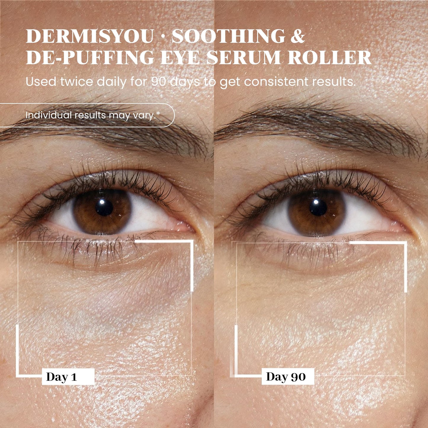 Dermisyou Under Eye Serum Roller Reduce Wrinkle & Fine Lines & Puffiness For Dark Circles Undereye Bags Women & Men Beauty & Personal Care Dermisyou