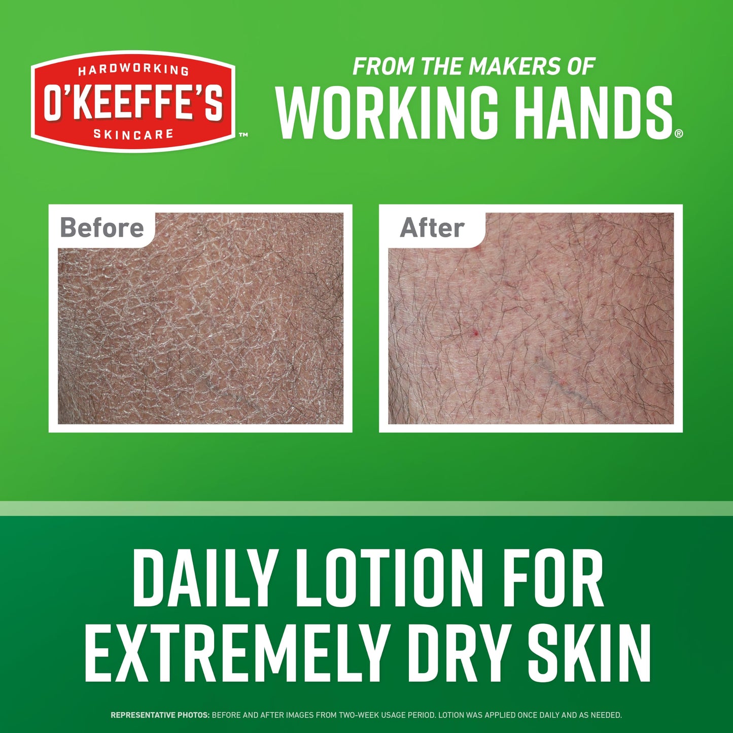 O’Keeffe’s Hardworking Body Lotion, Deep Hydration for Extremely Dry & Cracked Skin, 12 oz Pump (1 Pack), Fragrance-Free & Hypoallergenic, Non-Greasy Beauty & Personal Care O'Keeffe's