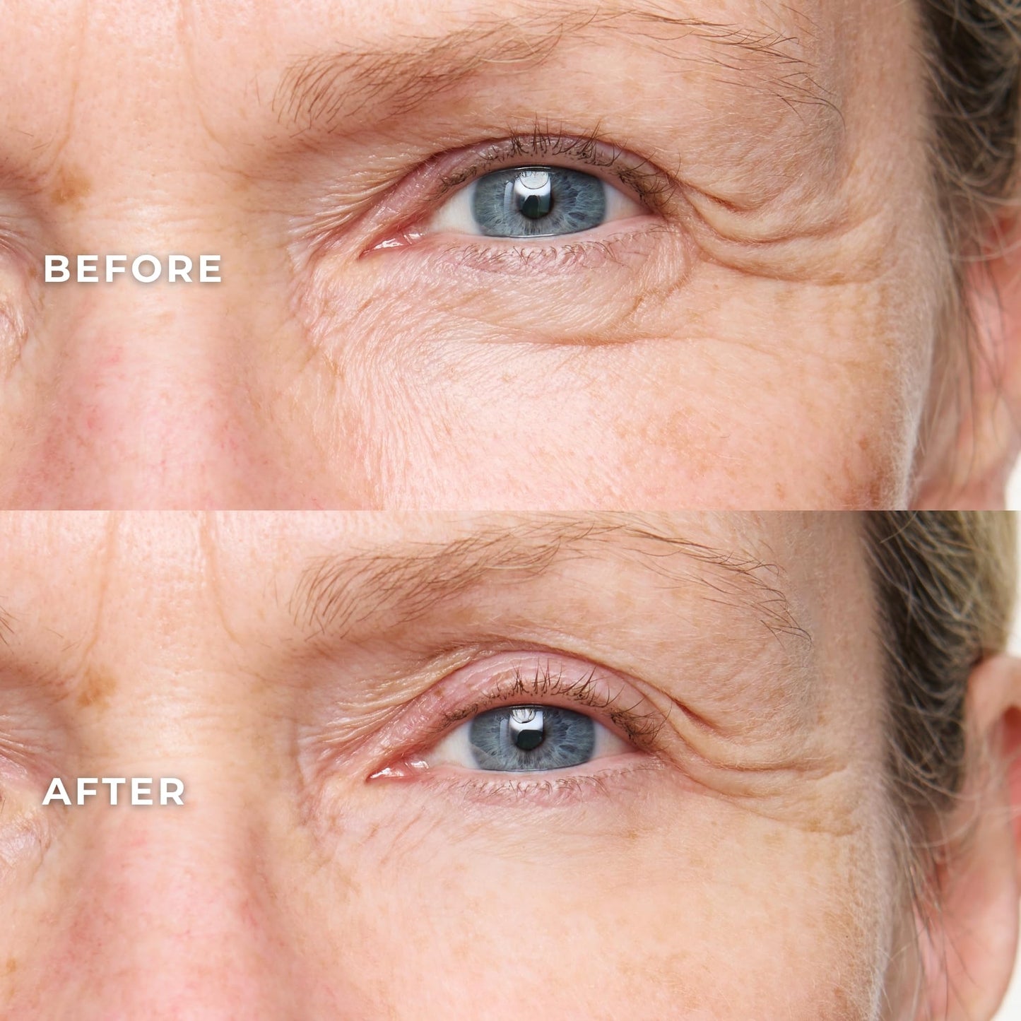 WUNDER2 Wunderlift Instant Eye Tightening Serum, Temporary Firming & Lifting Treatment in 60 Seconds, Reduces Under-Eye Bags, Dark Circles, Puffiness Beauty & Personal Care Wunder2