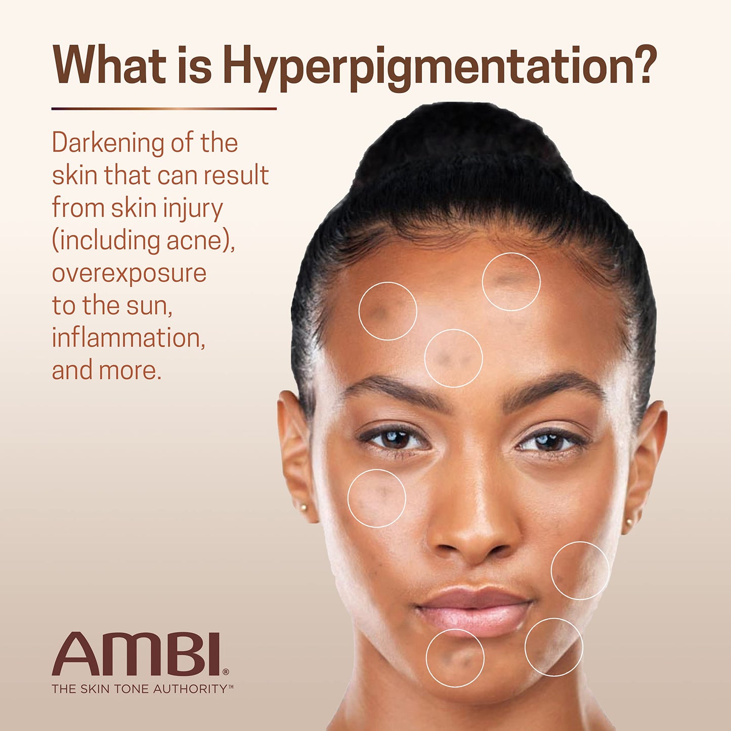 Ambi Even & Clear Fade Serum, Hyperpigmentation Treatment, Hydroquinone-free, Dark Spot Corrector, Results In As Little As 4 Weeks, Retinol Beauty & Personal Care Ambi