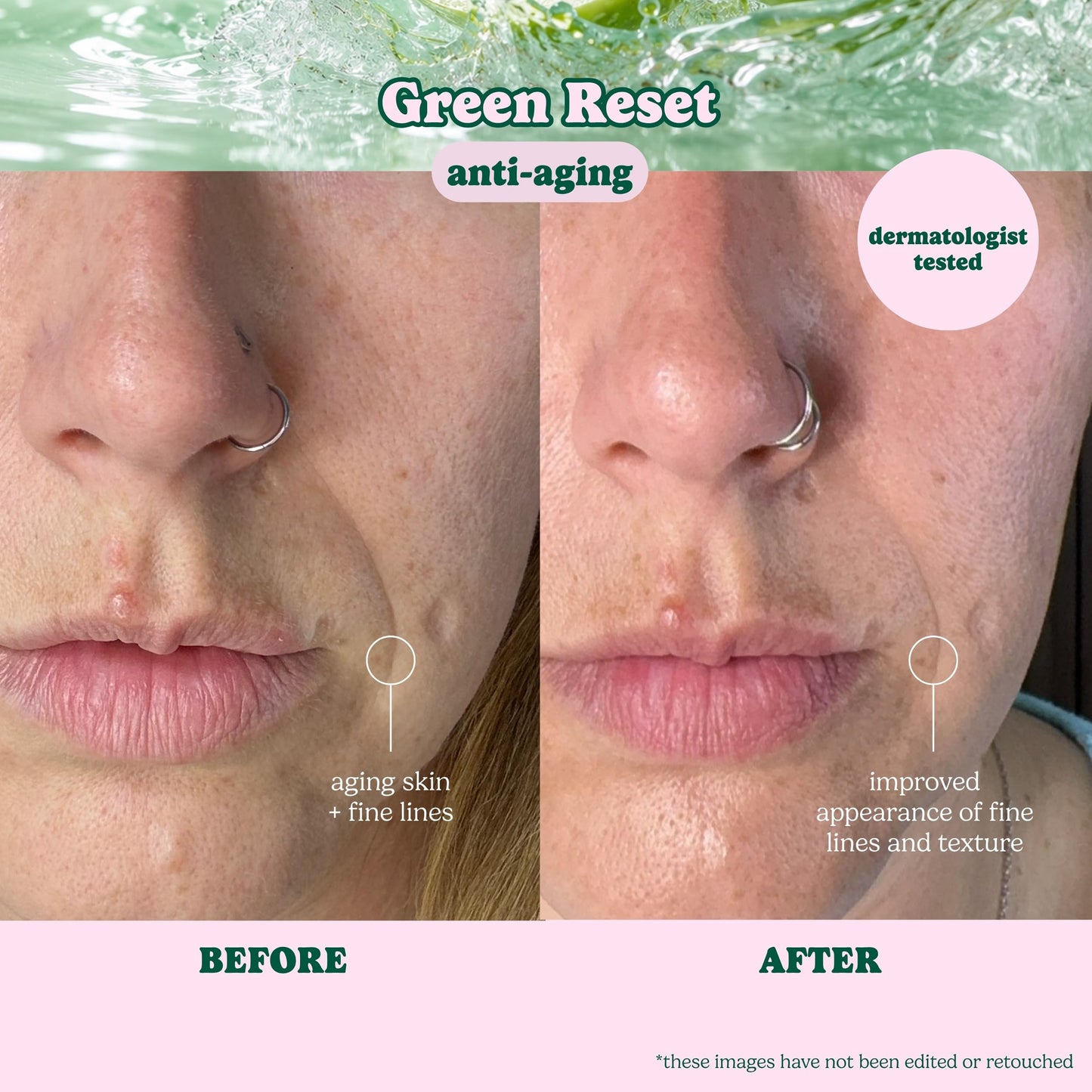 ESW Beauty Green Reset Anti-Aging Korean Face Mask - Vitamin C, Hyaluronic Acid & Kale for Collagen Support, Smooth Skin & Hydration - Skincare Gifts Beauty & Personal Care ESW Beauty