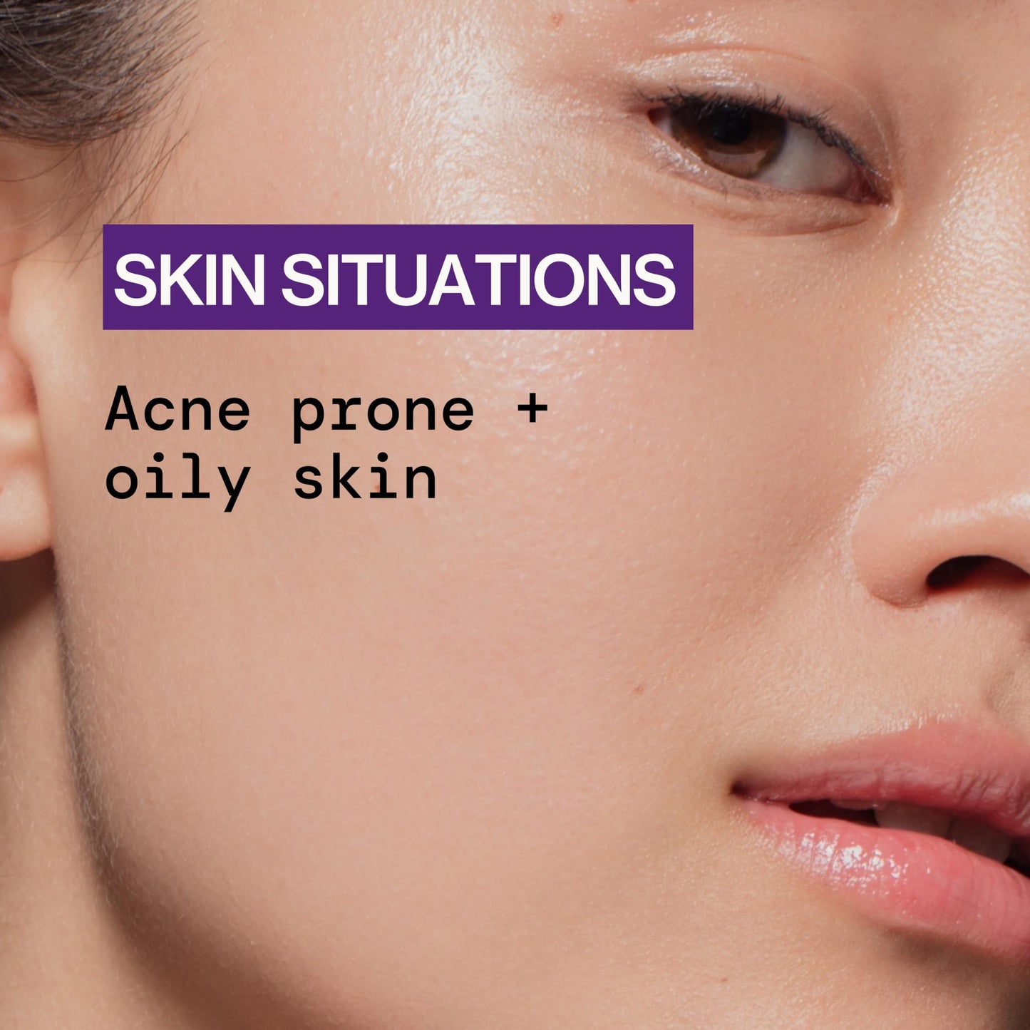 Pacifica Acne Spot Treatment & Pimple Cream - Dry It Out Gel with 2% Salicylic Acid, Witch Hazel, Niacinamide - Dries Blemishes Overnight, Fights Beauty & Personal Care Pacifica
