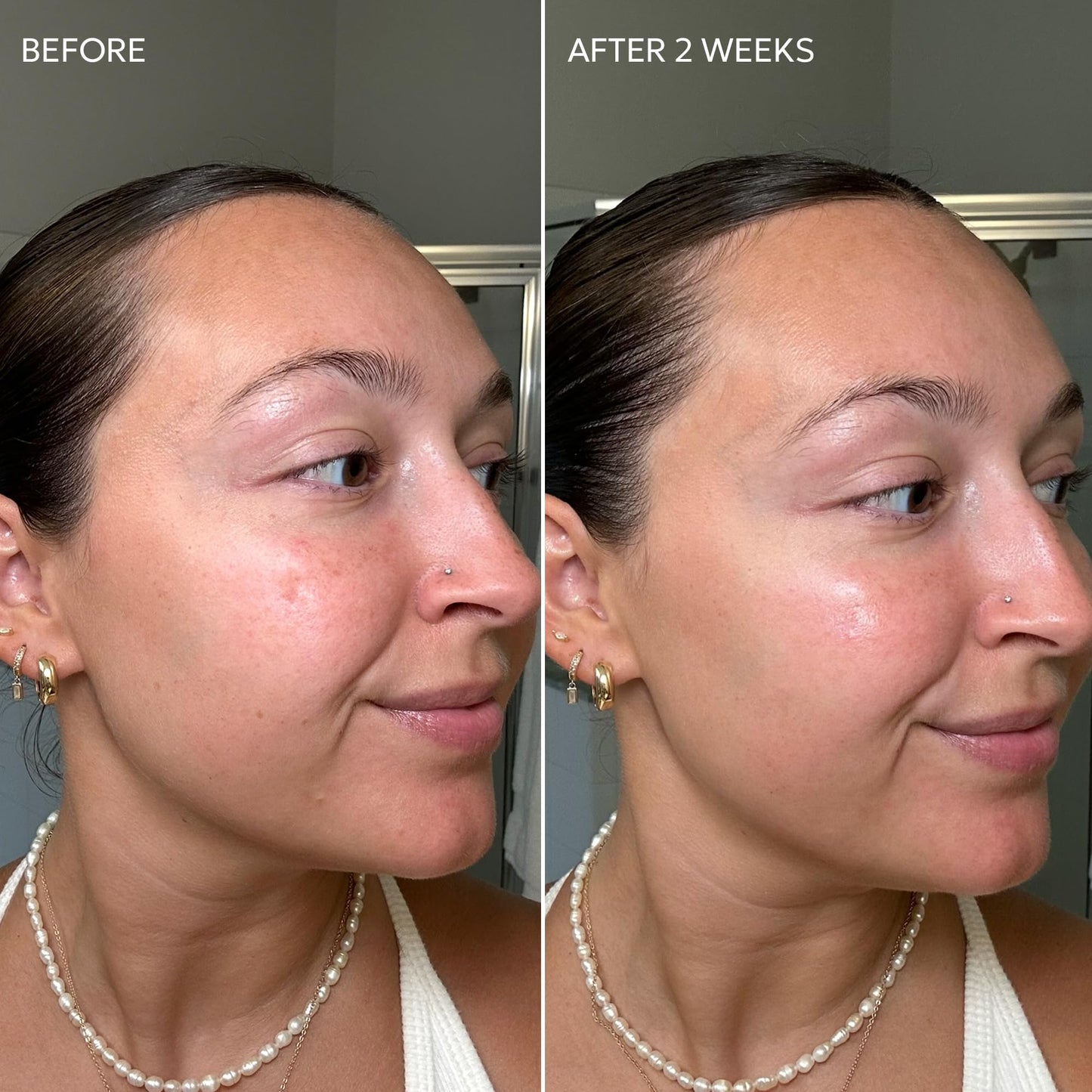Dermisa Skin Fade Cream with Vitamin C, Licorice and Emblica - Dark Spot Corrector and Face Moisturizer for Sun Spots, Age Spots and Freckles - 1.78 Beauty & Personal Care Dermisa